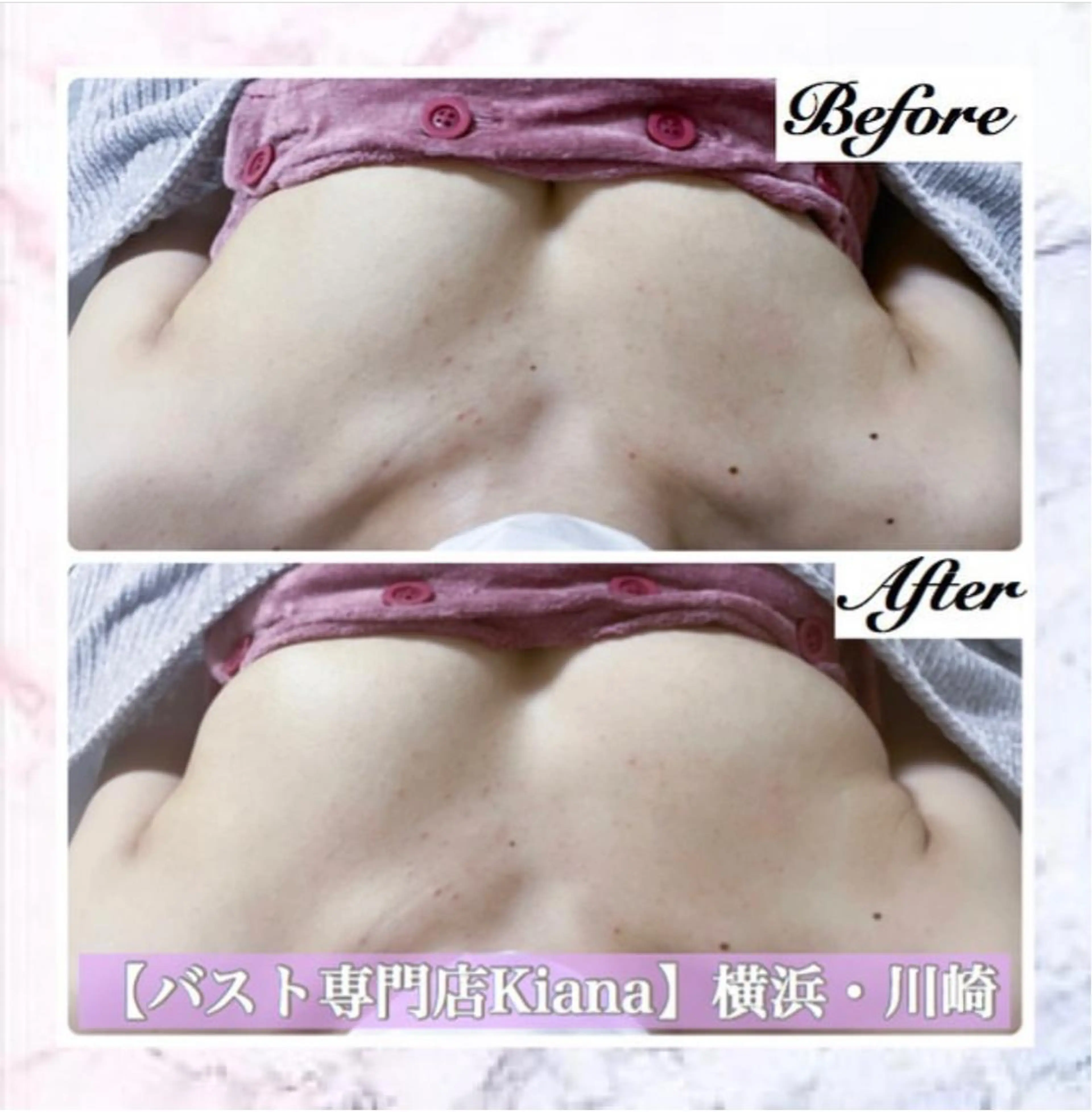 エステ リラク バスト専門Kiana 風のエステ・リラクイメージ