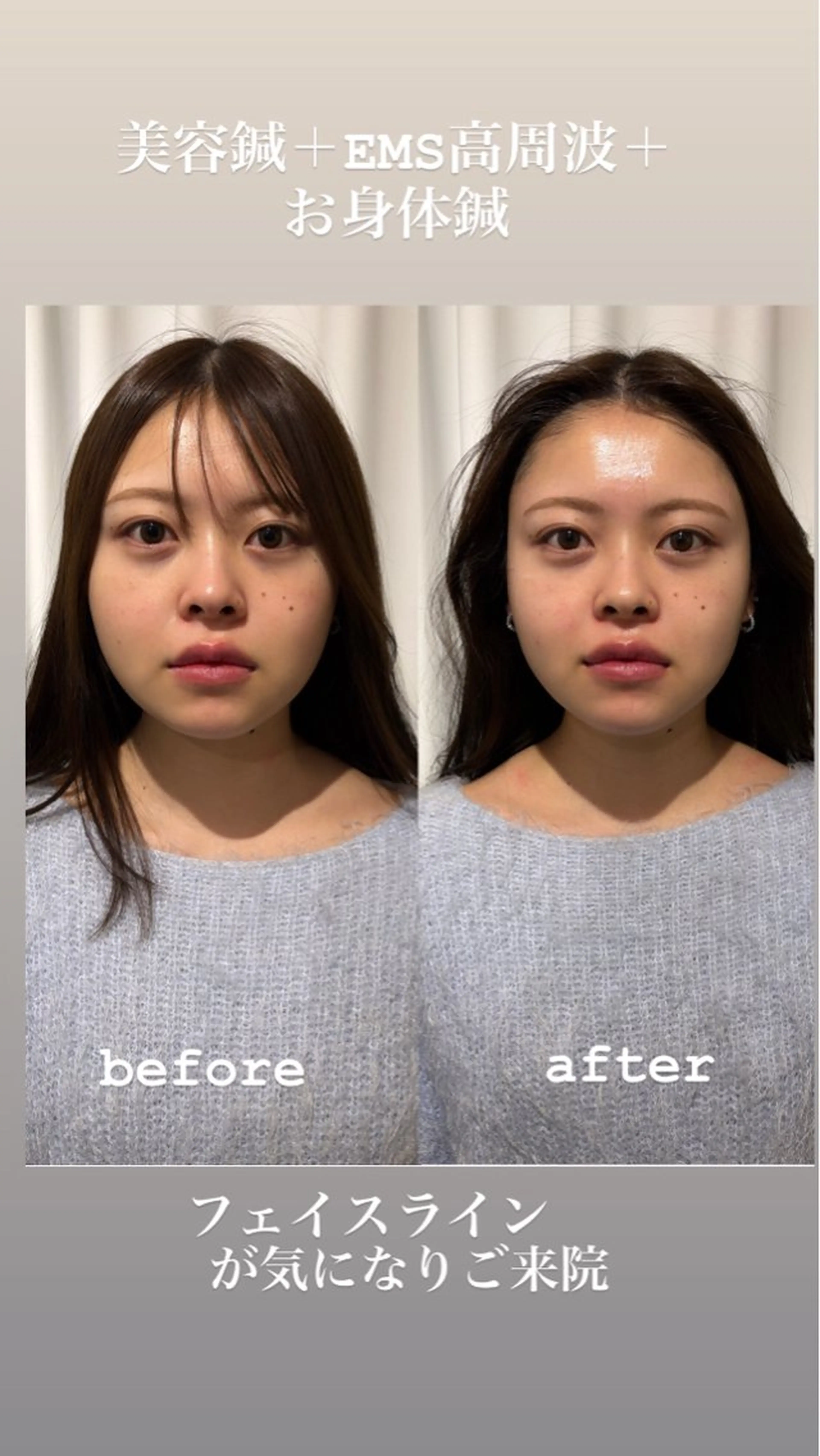 エステ リラク 美容鍼灸サロン mahoroba院長のエステ・リラクイメージ