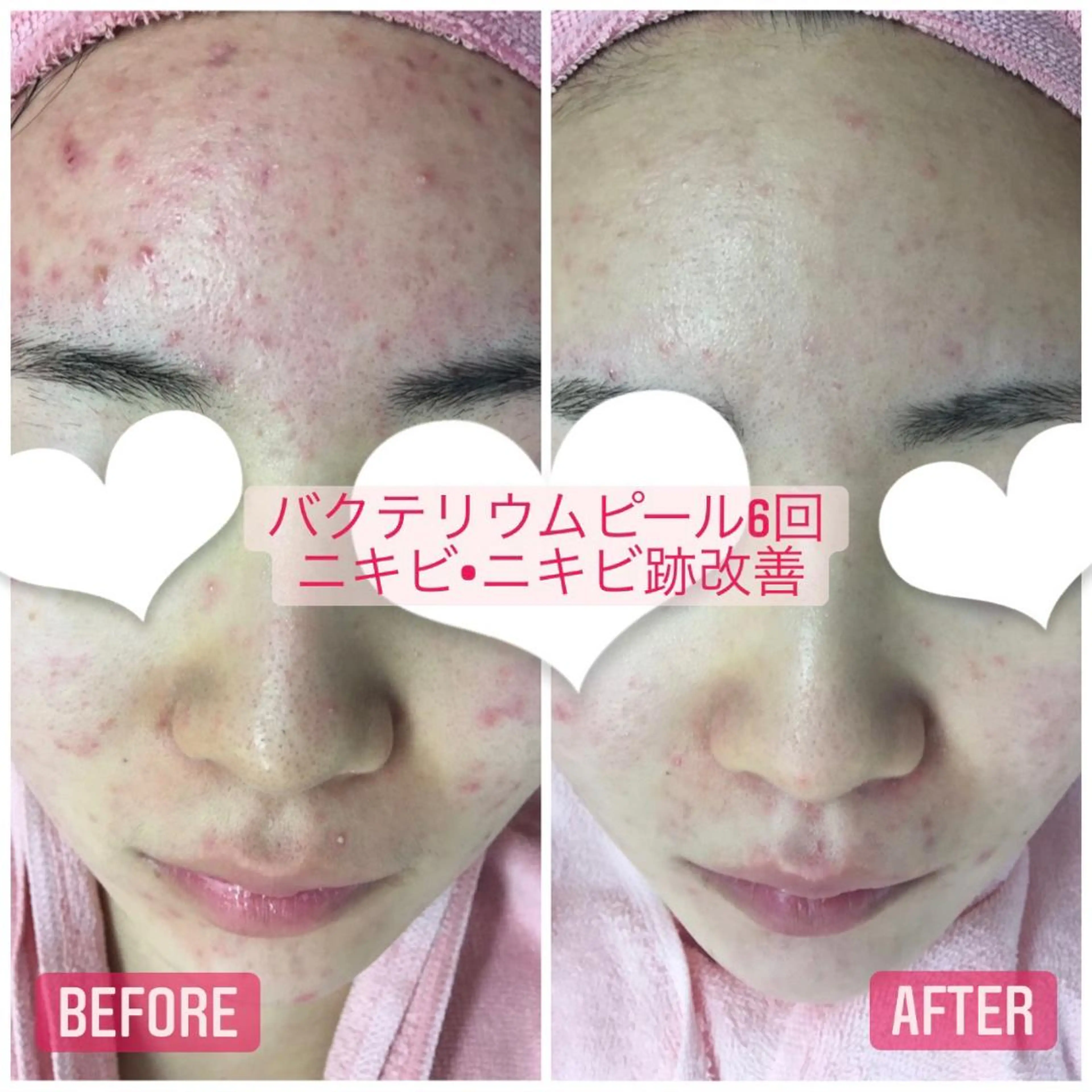 透明感の肌Lino malieのエステ・リラクイメージ