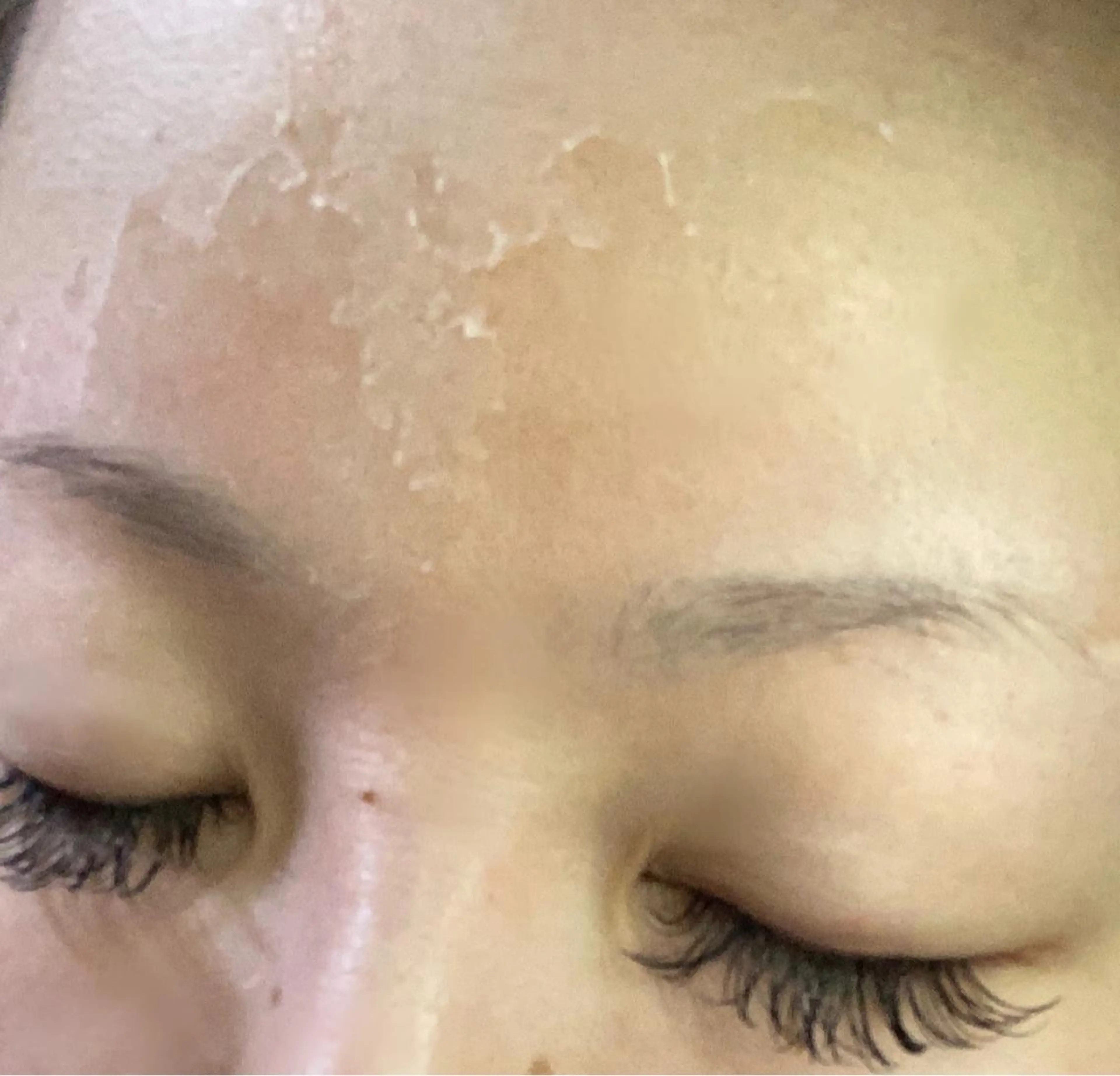 【剥離有り】剥離後はむきたまご🥚💕人気REVIハードトリートメント🌱 メンズOKの写真