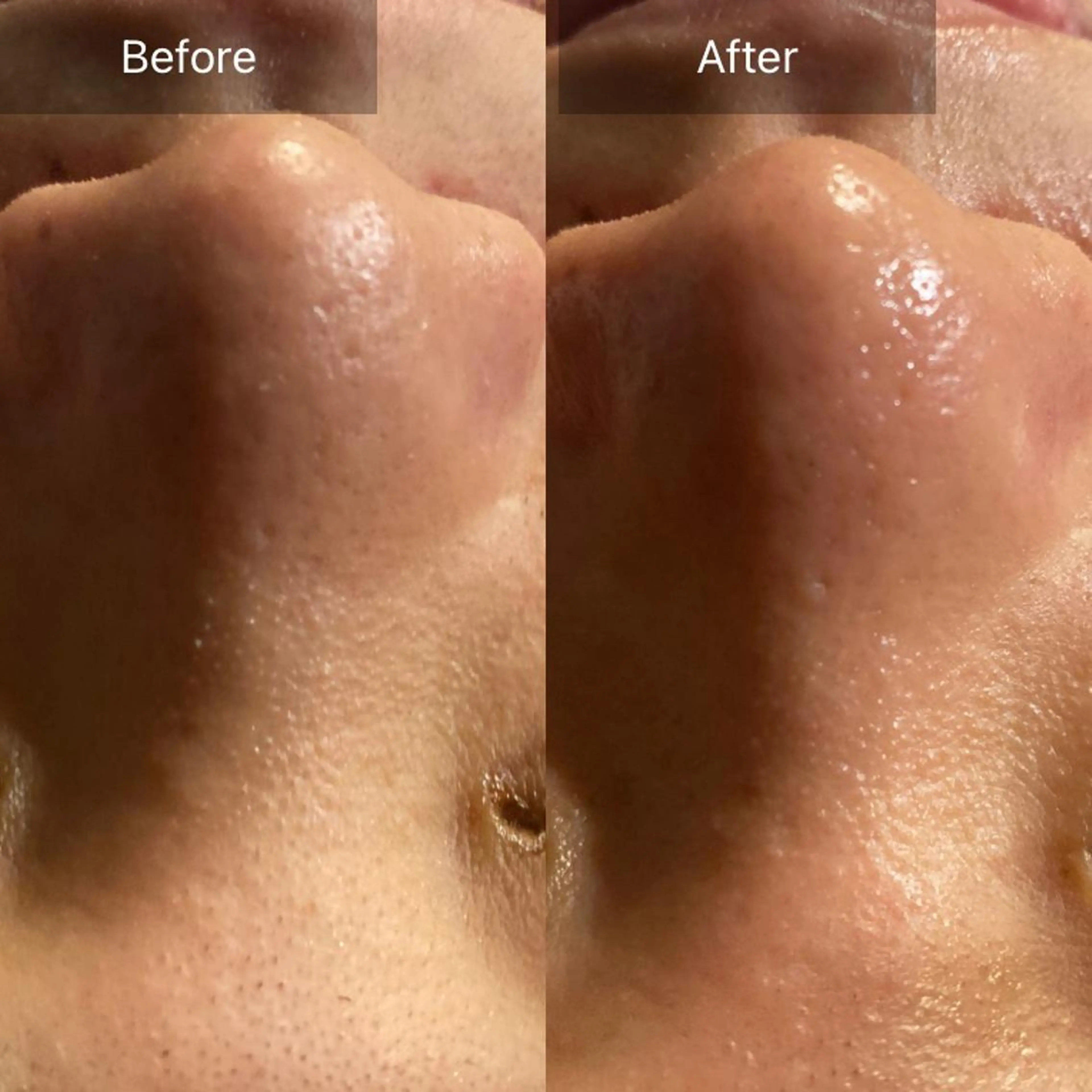 Mandarin Orange所属・毛穴から始める肌メン テマンダリンオレンジのエステ・リラクイメージ