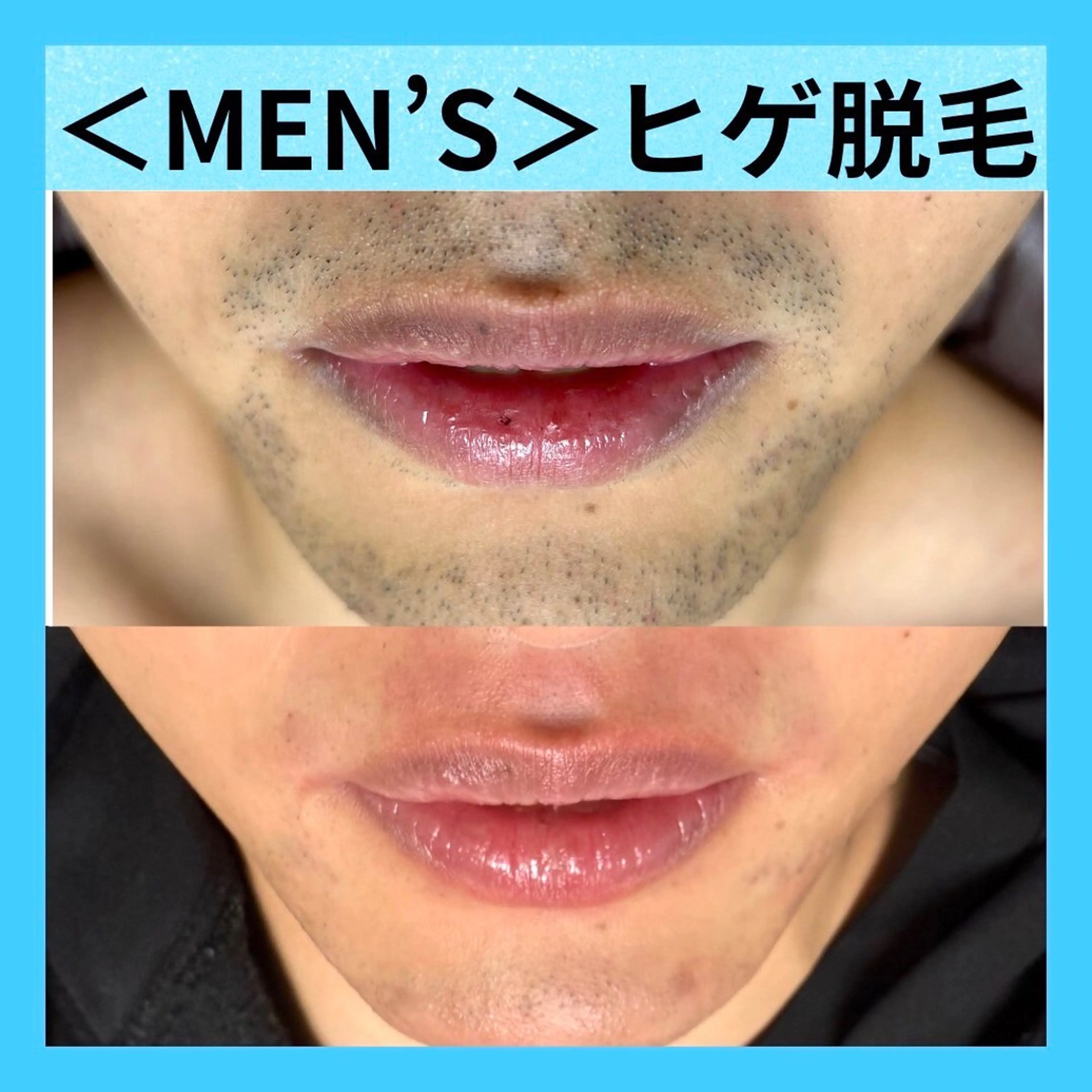 メンズ メディカルエステ マドンナのエステ・リラクイメージ