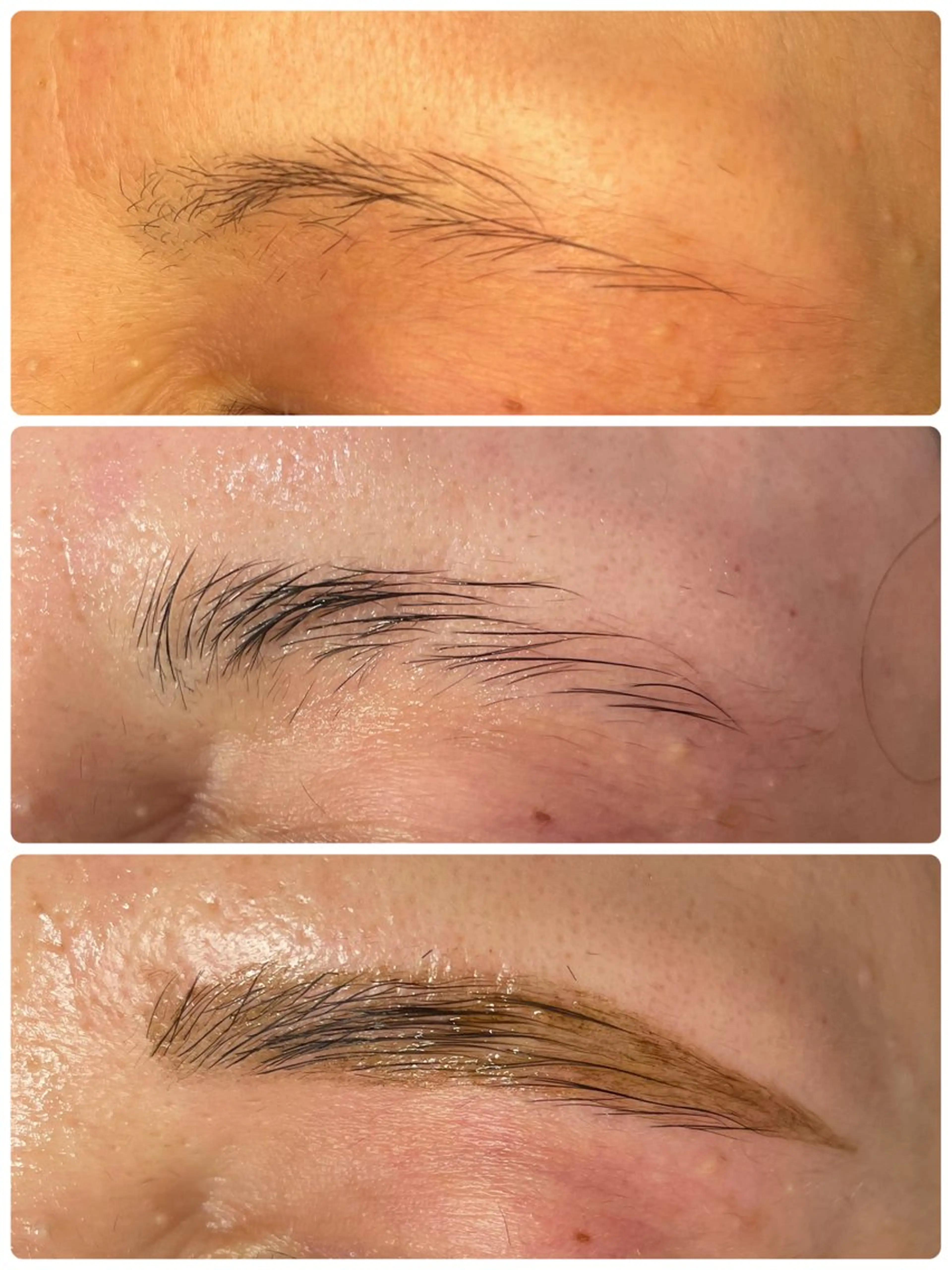 〈ブロウアディクト（眉ケア）〉¥4378ーインスタ&雑誌各社に紹介多数掲載💙最高級育毛サロン専門プロケア（1回）の写真