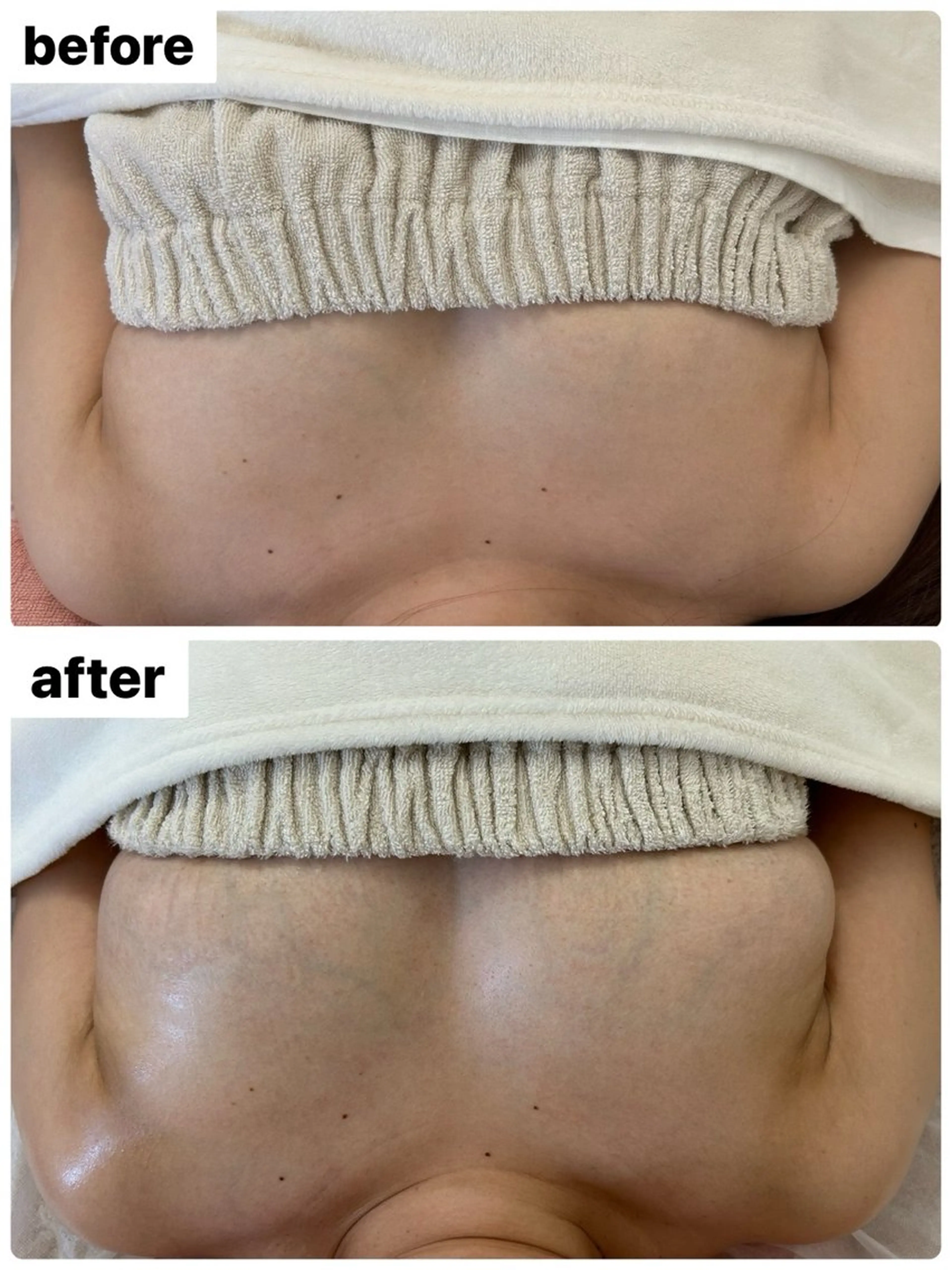 バスト/腸もみ/美肌 サロンLelalaのエステ・リラクイメージ