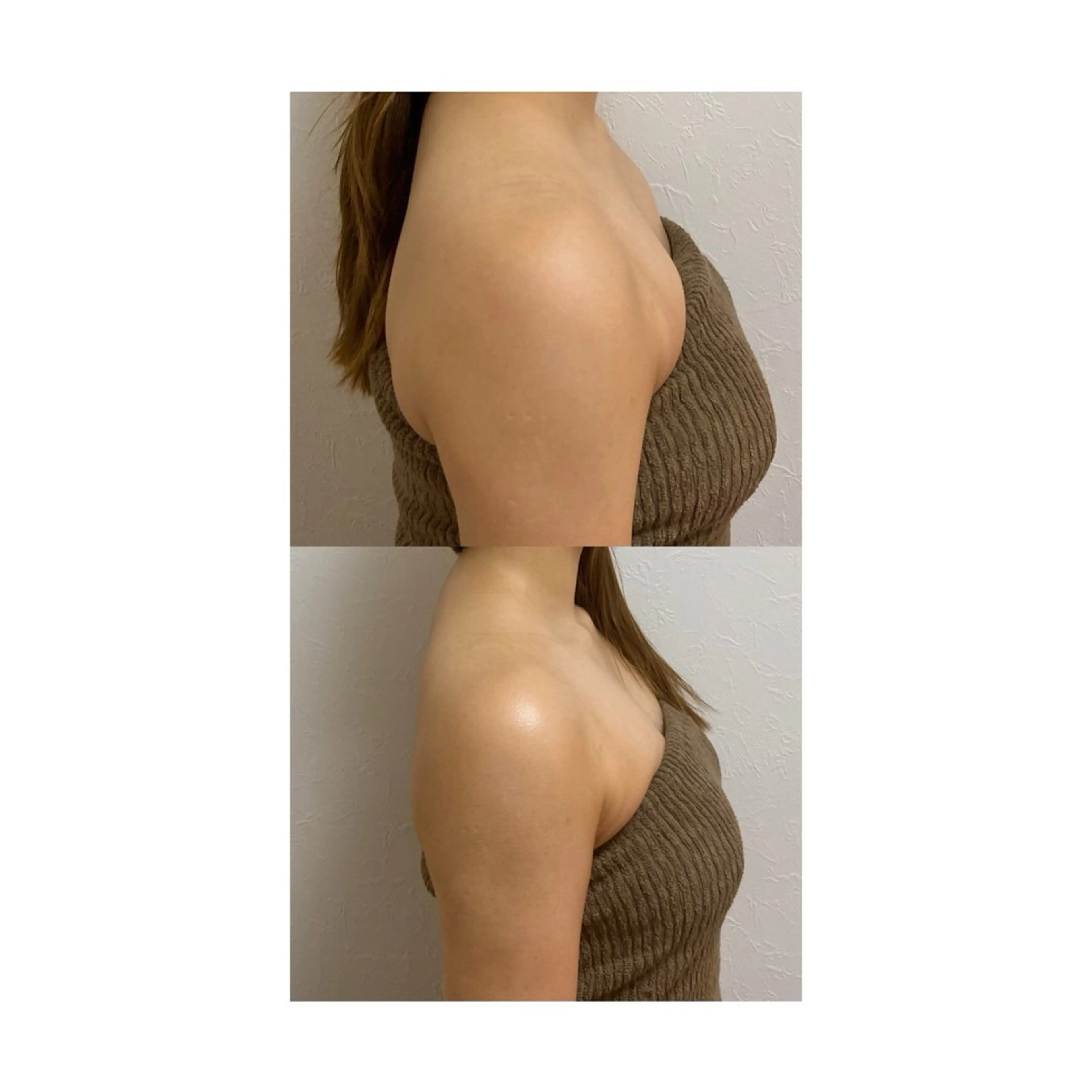 100 minutes ~ fullcourse ~の写真