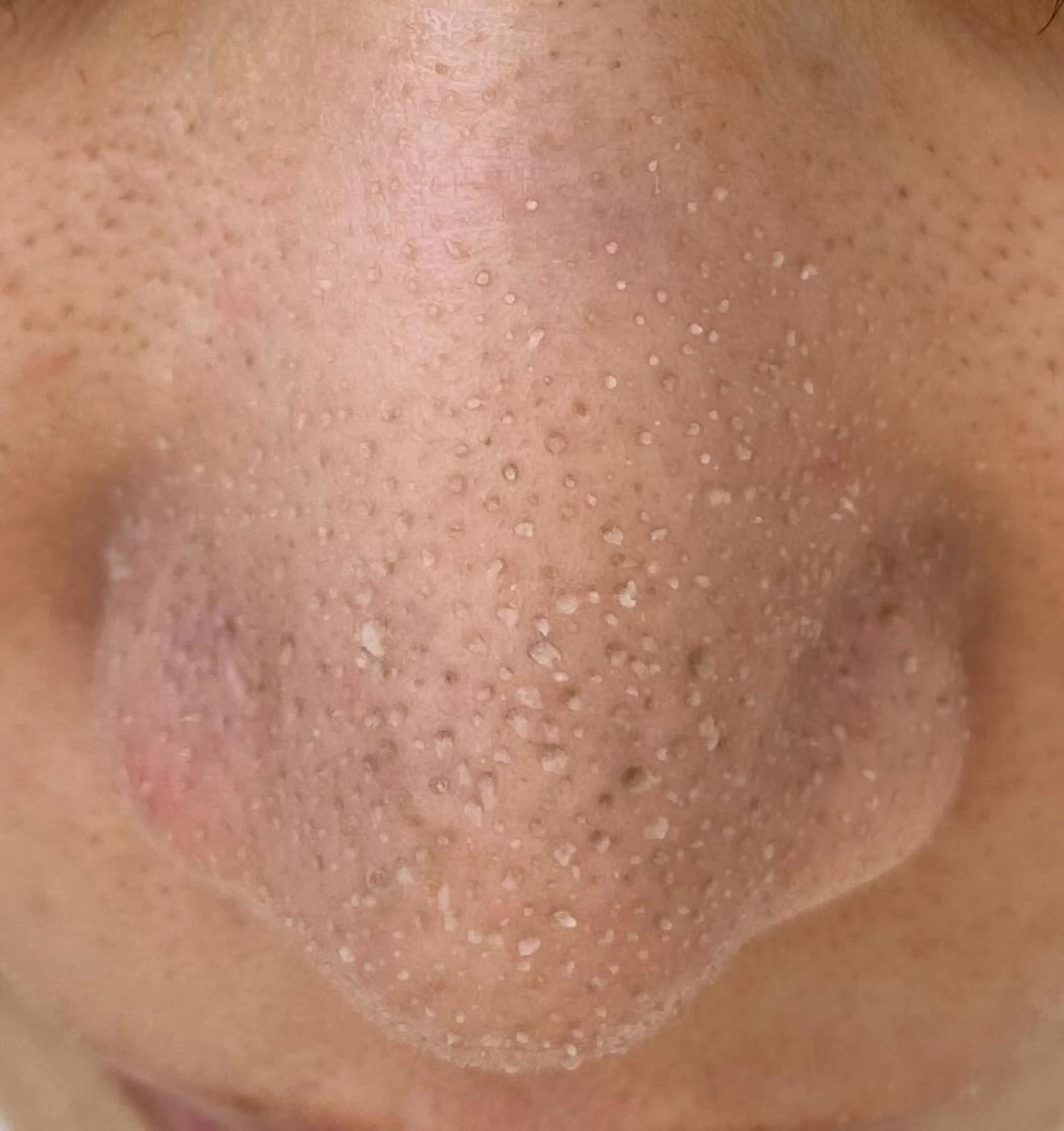 Ummi所属・肌管理／眉毛．まつ毛 陽子の眉毛・アイブロウイメージ