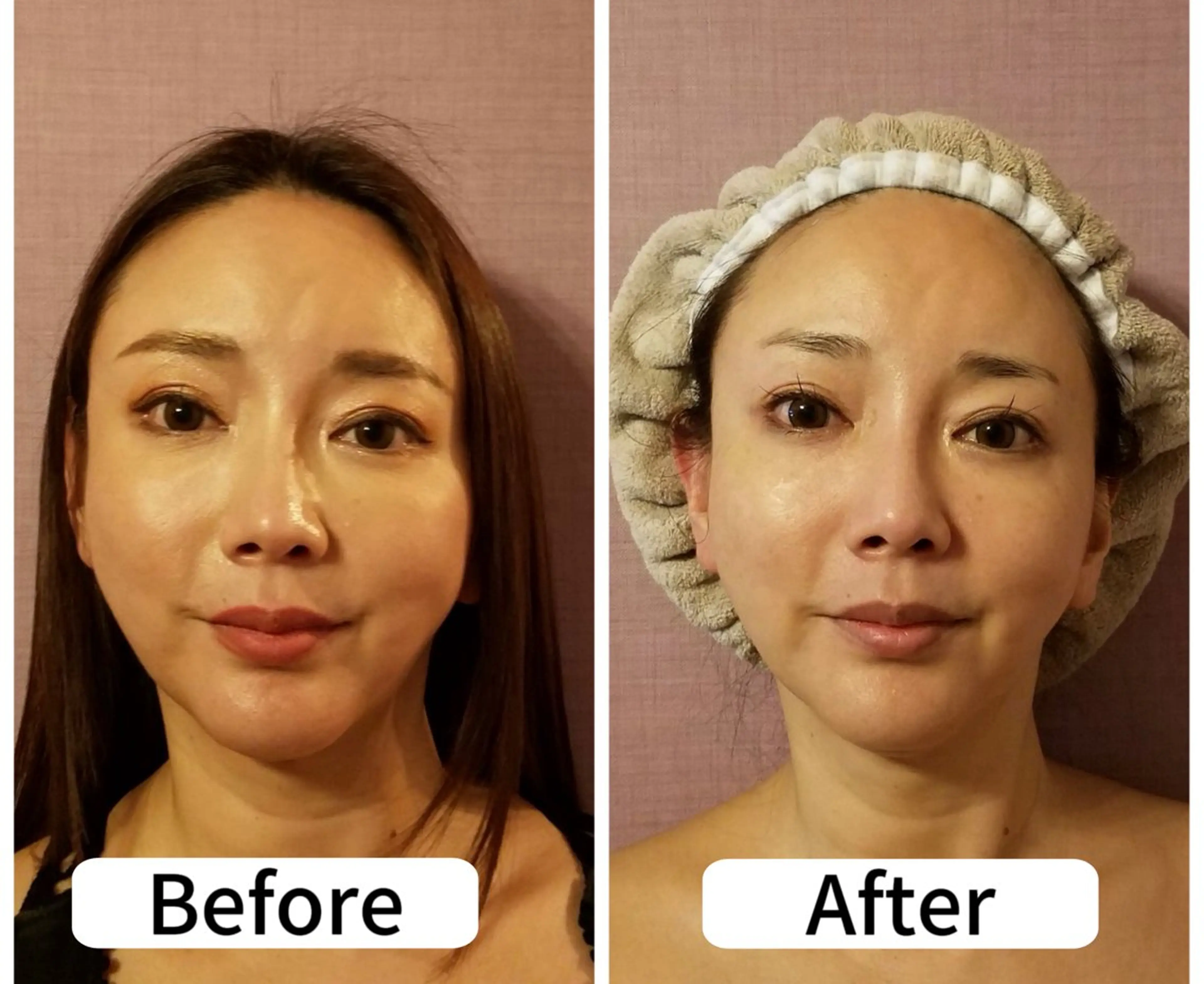 アンベリーノ Yuuriのエステ・リラクイメージ