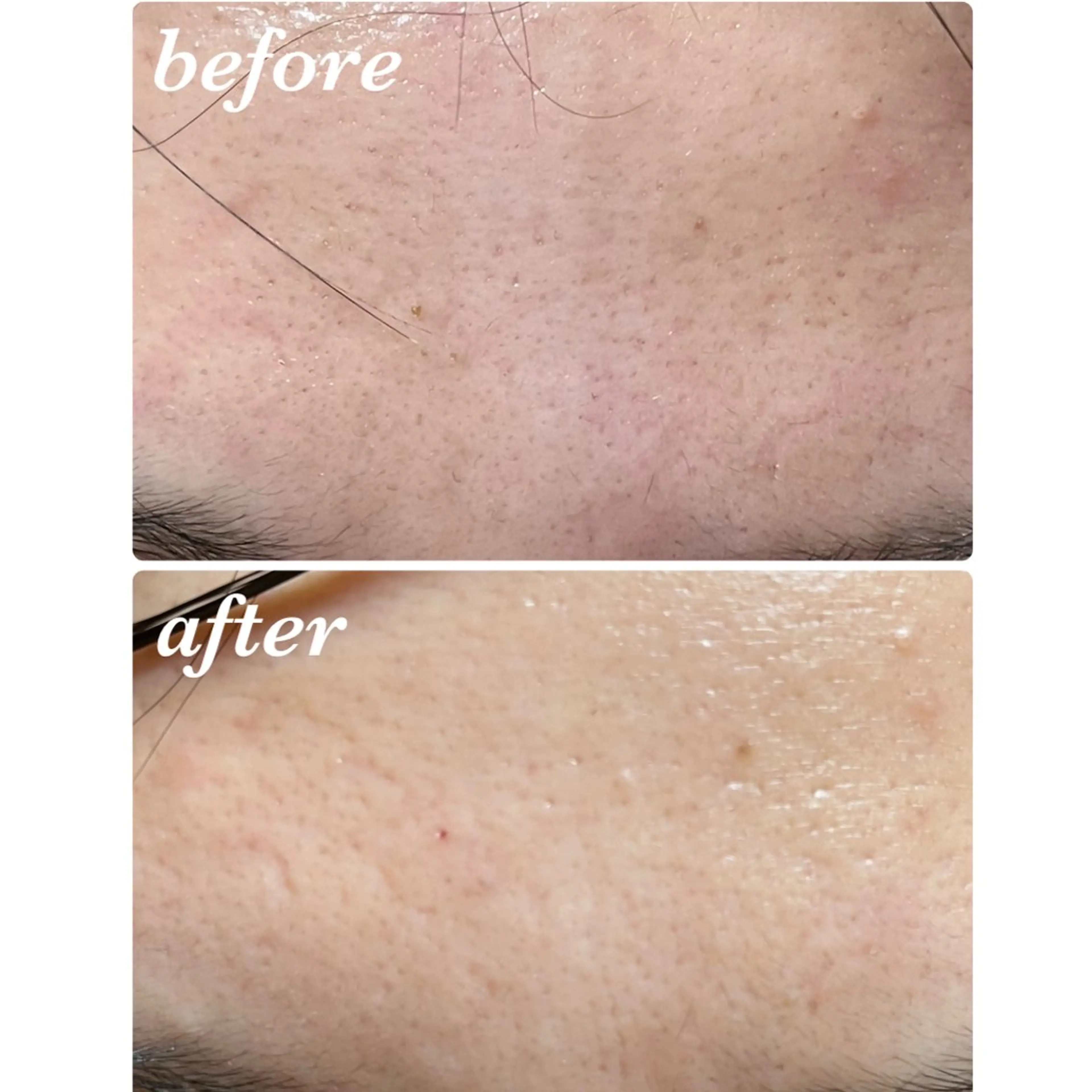 結果重視｜毛穴エステ ｜友綱理恵のエステ・リラクイメージ