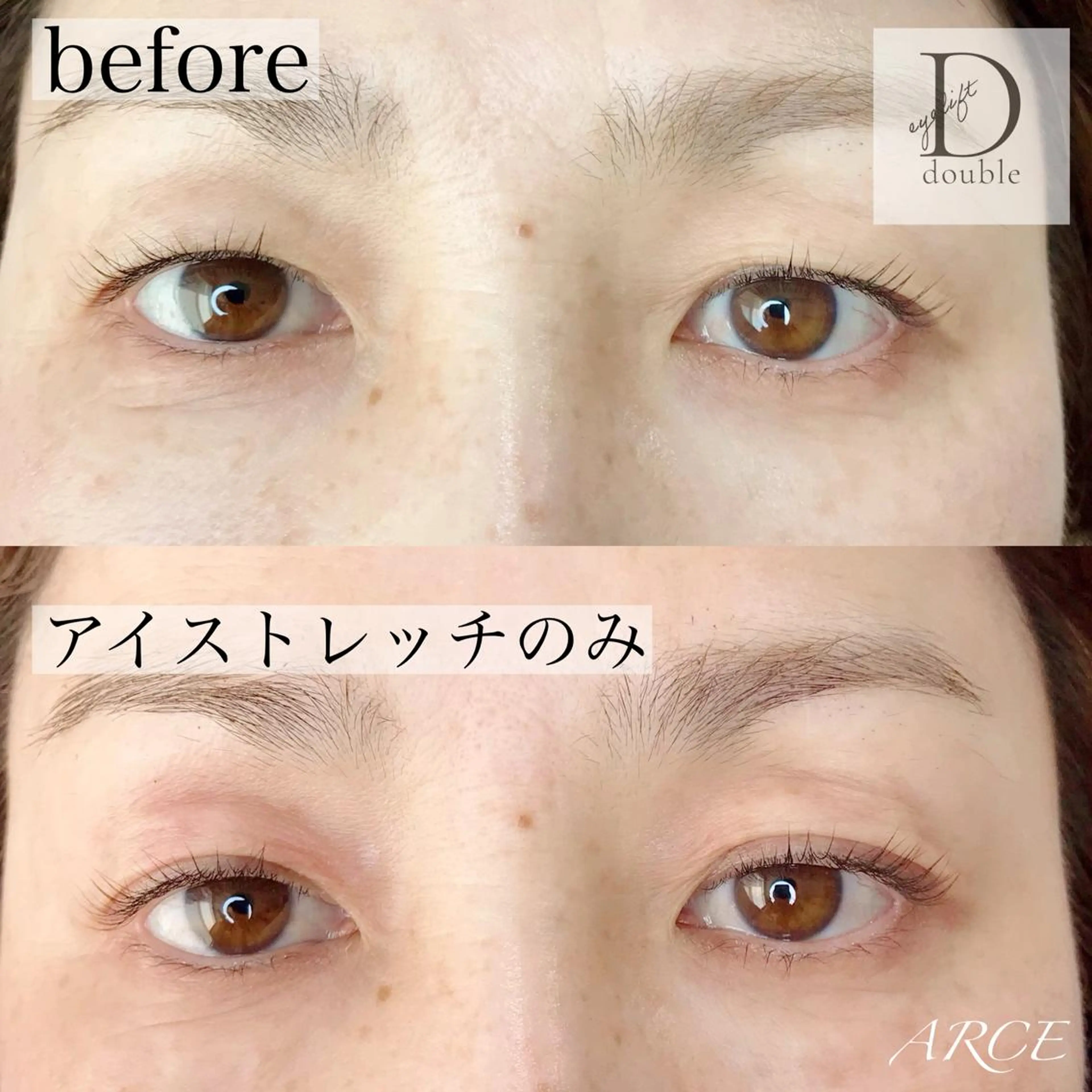 マツエク・マツパ 美容室 ARCE所属・セラピスト MIKIのエステ・リラクイメージ