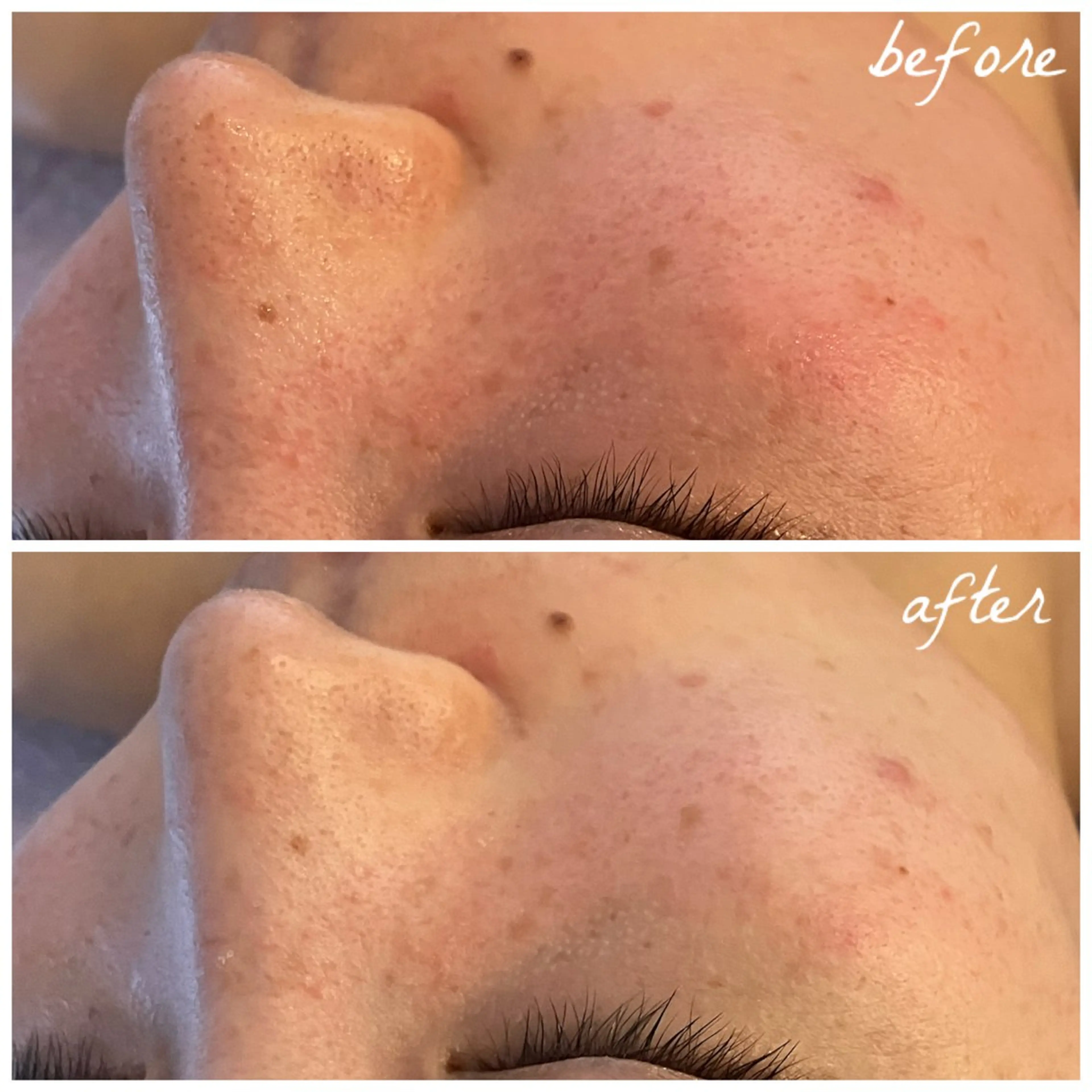 メンズ エステ メナード岐阜茜部 杉浦のエステ・リラクイメージ