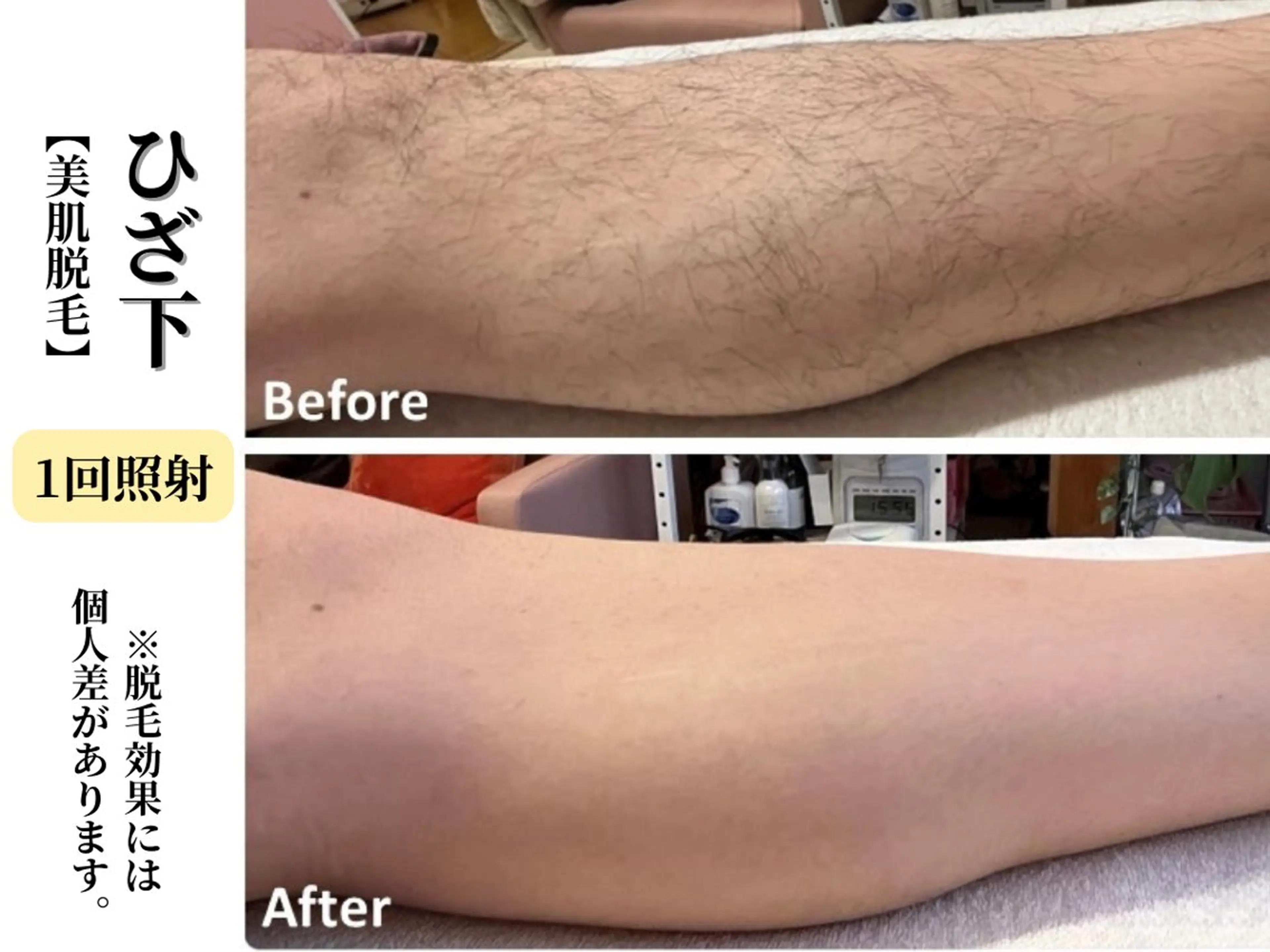 脱毛 Belle White所属・本格痩身＊肌質改善＊ BelleWhiteのエステ・リラクイメージ