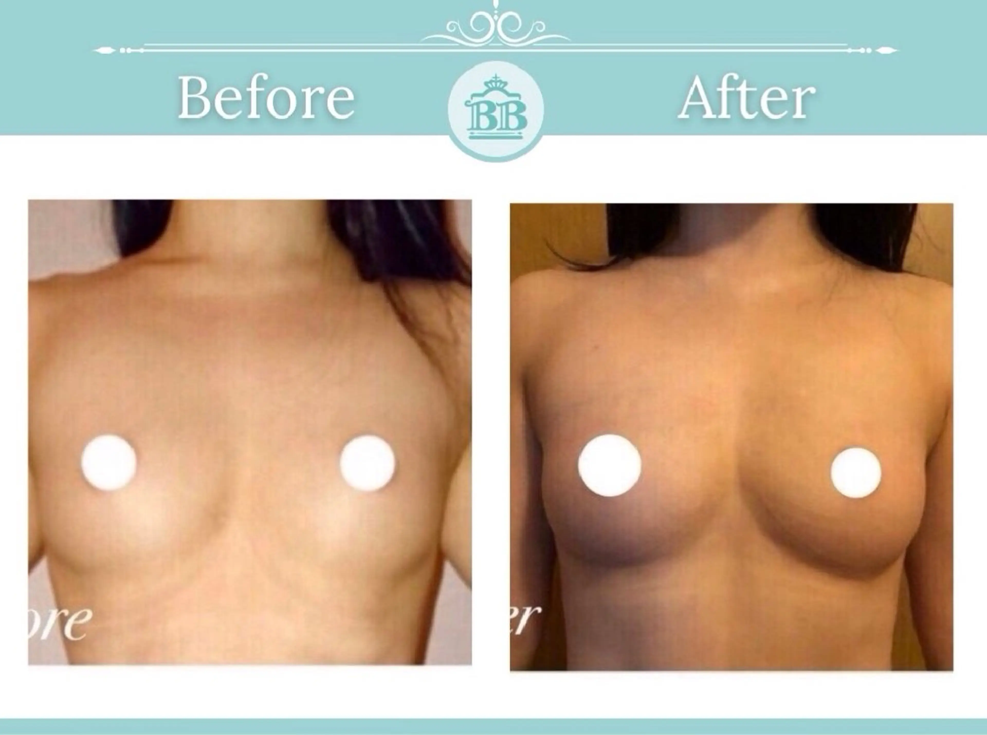 エステ 美人バスト本厚木店所属・美人バスト 本厚木店のエステ・リラクイメージ