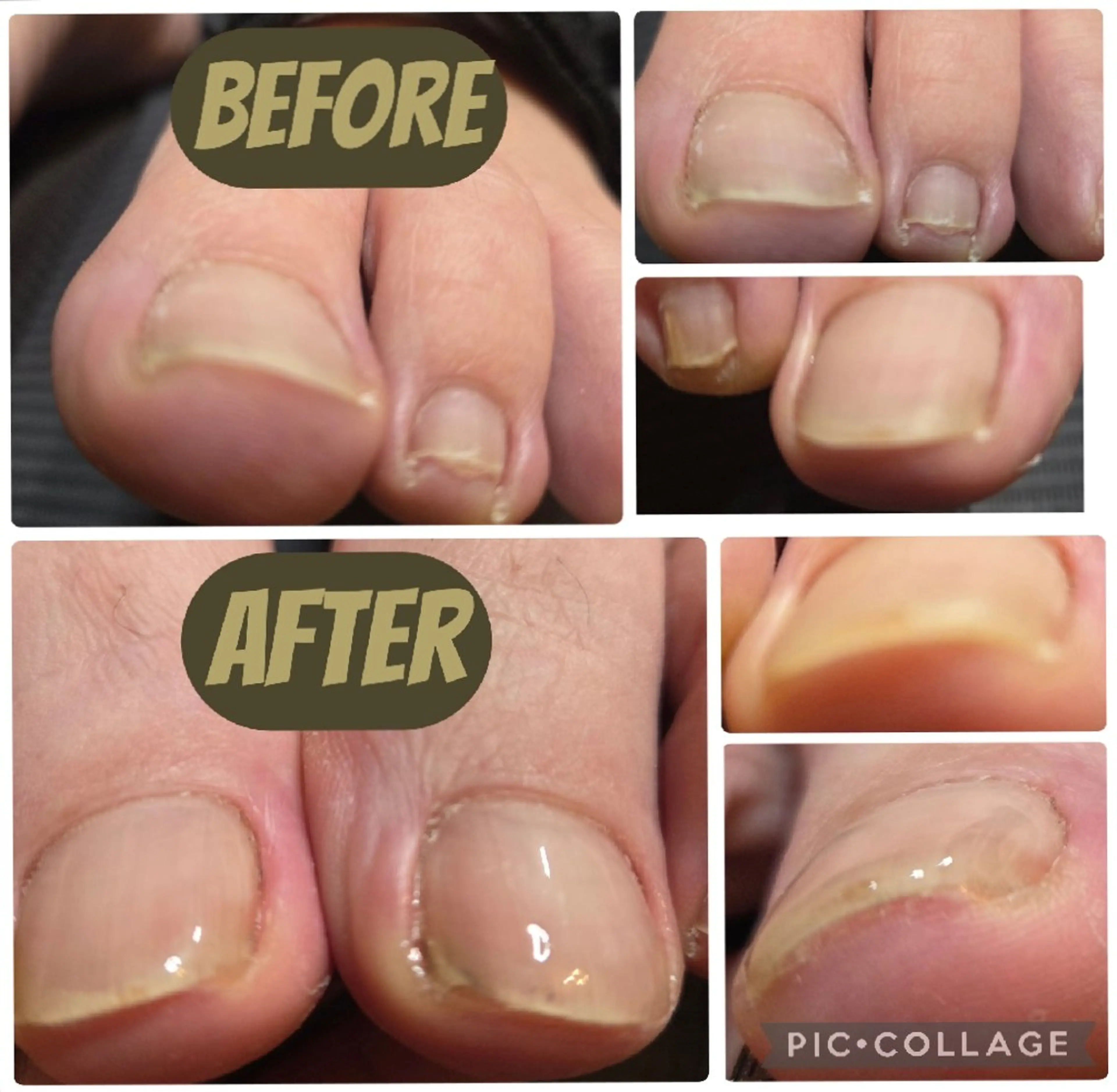 ネイル ジェルネイル nailsaron kohiroのネイルデザイン