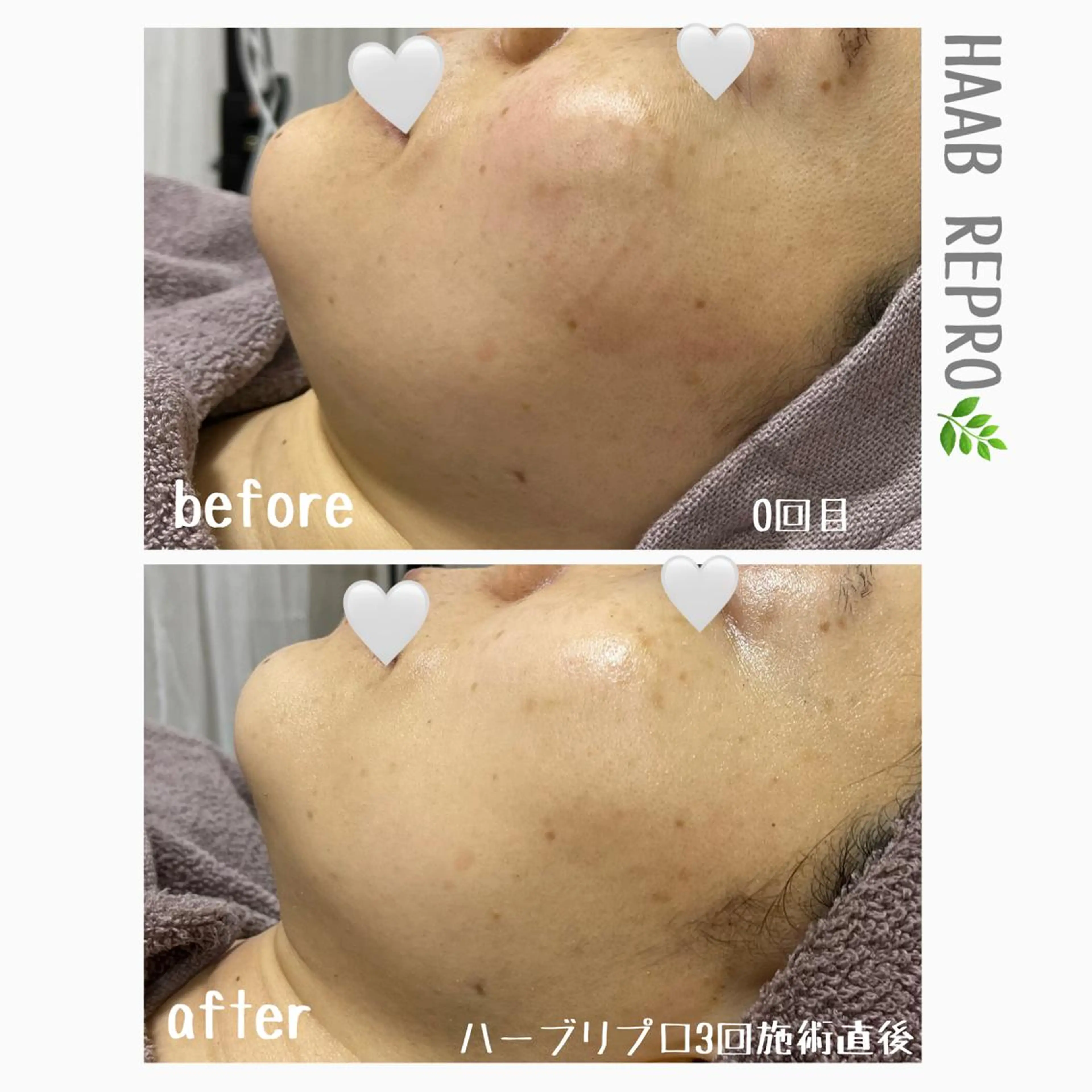 1ヶ月後も半分残る 高持続LEDエクステのマツエク・マツパデザイン