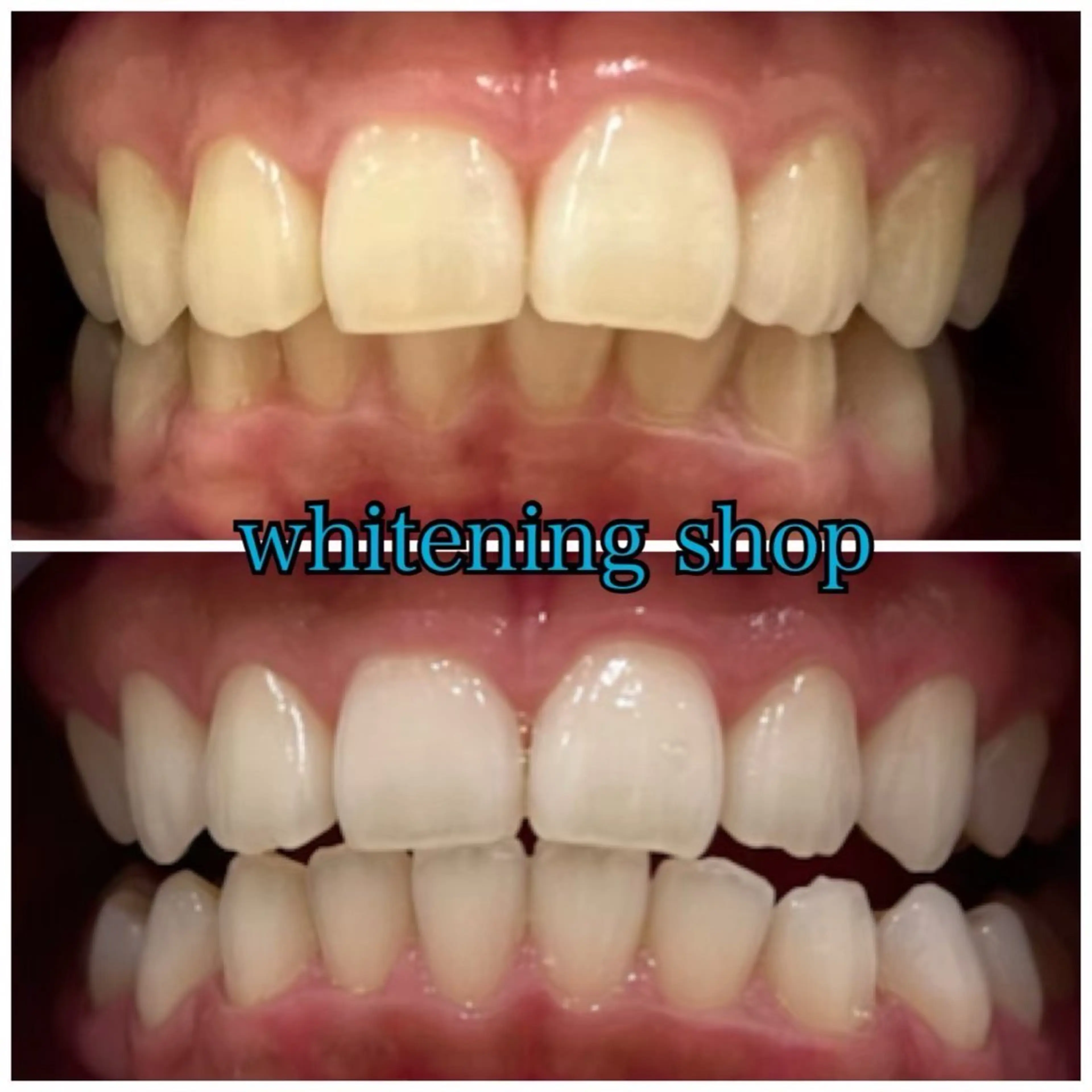 その他 ホワイトニングショップせんげん台店所属・スタッフ 兎洞のその他イメージ