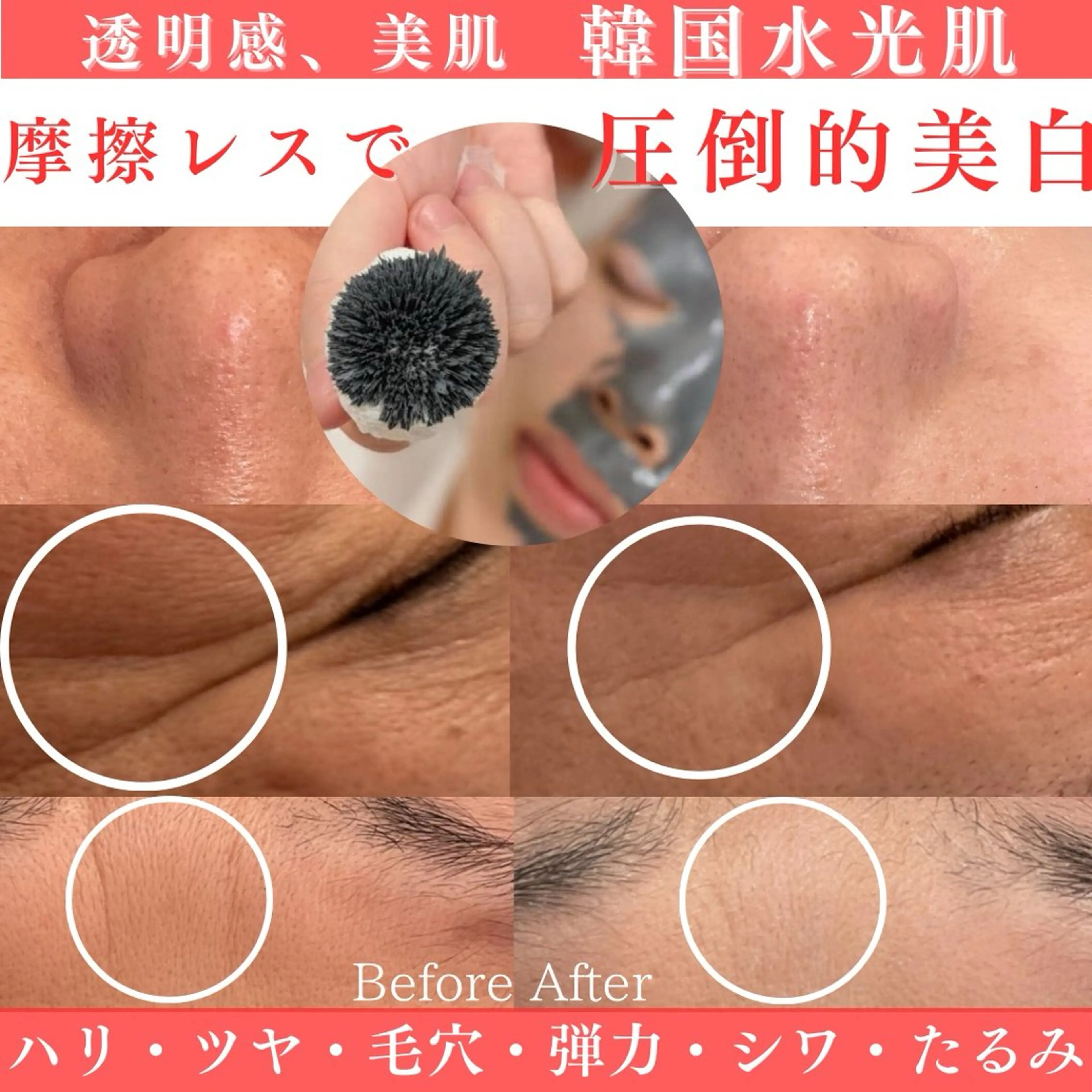 圧倒的美白！肌質改善​〜​水光肌へ​〜​毛穴/ほうれい線等効果期待大◎/MONNALI復元パック¥19000→¥13000※全顔の写真