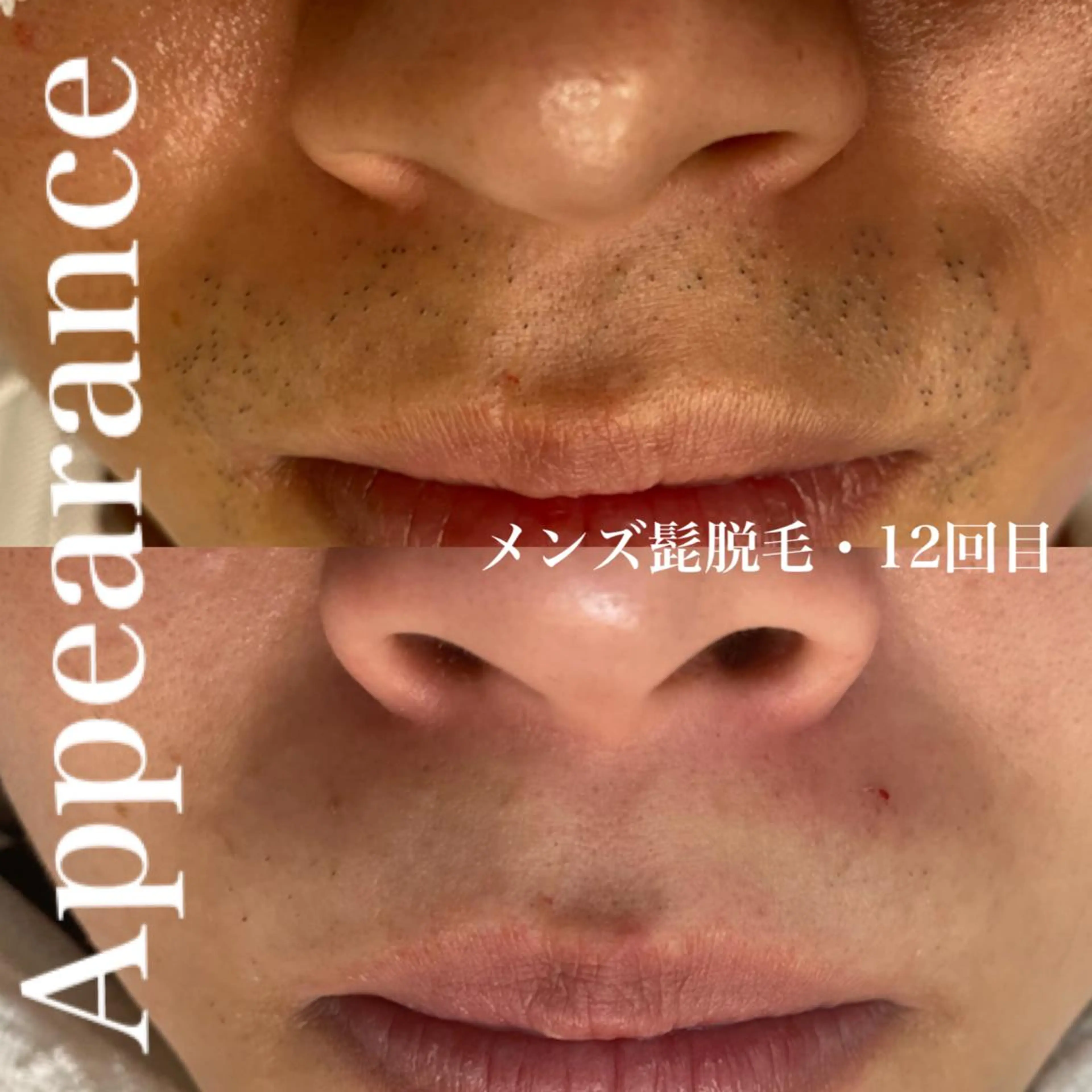 Appearance所属・Appearance 【アピアランス】のエステ・リラクイメージ