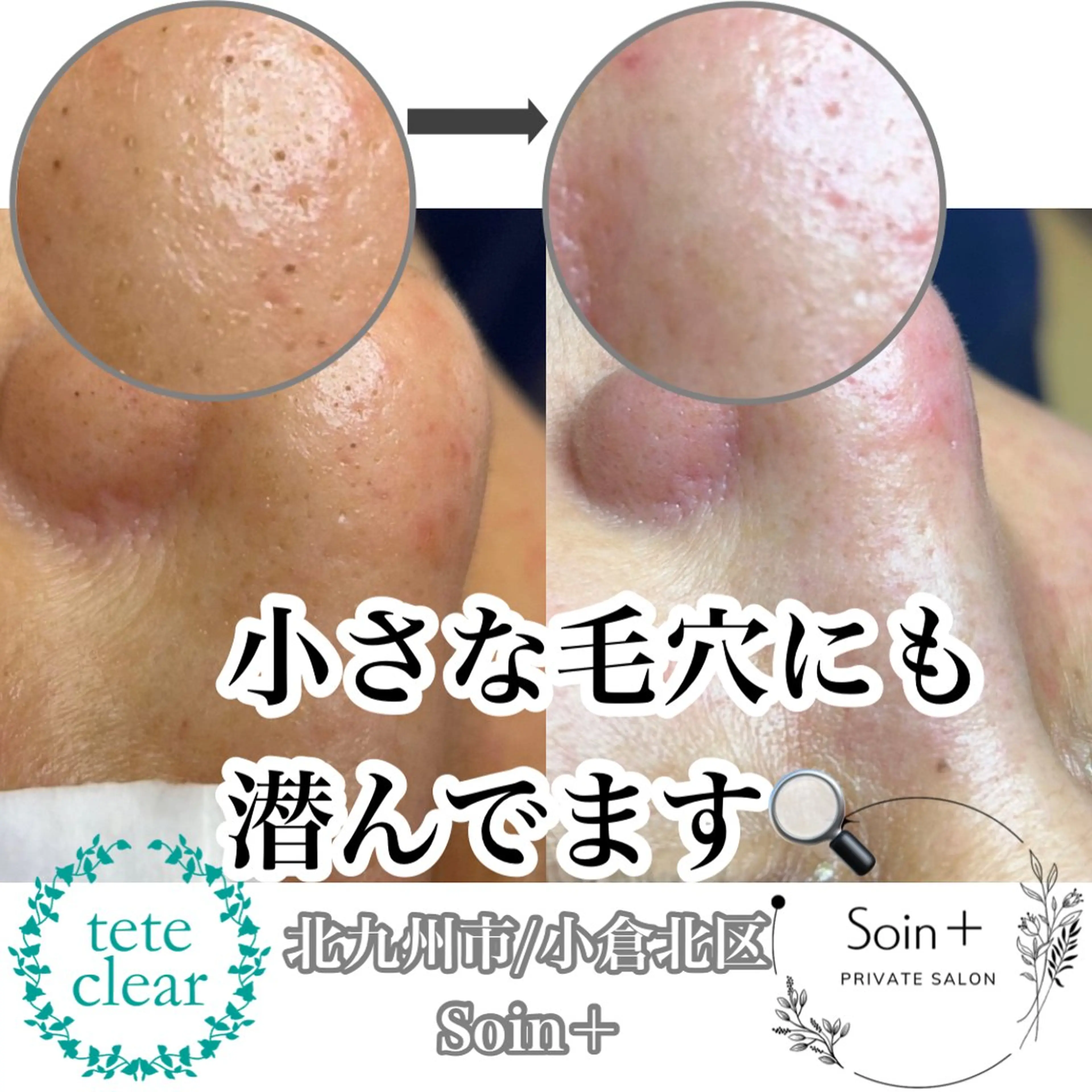 エステ Soin＋ みきのエステ・リラクイメージ