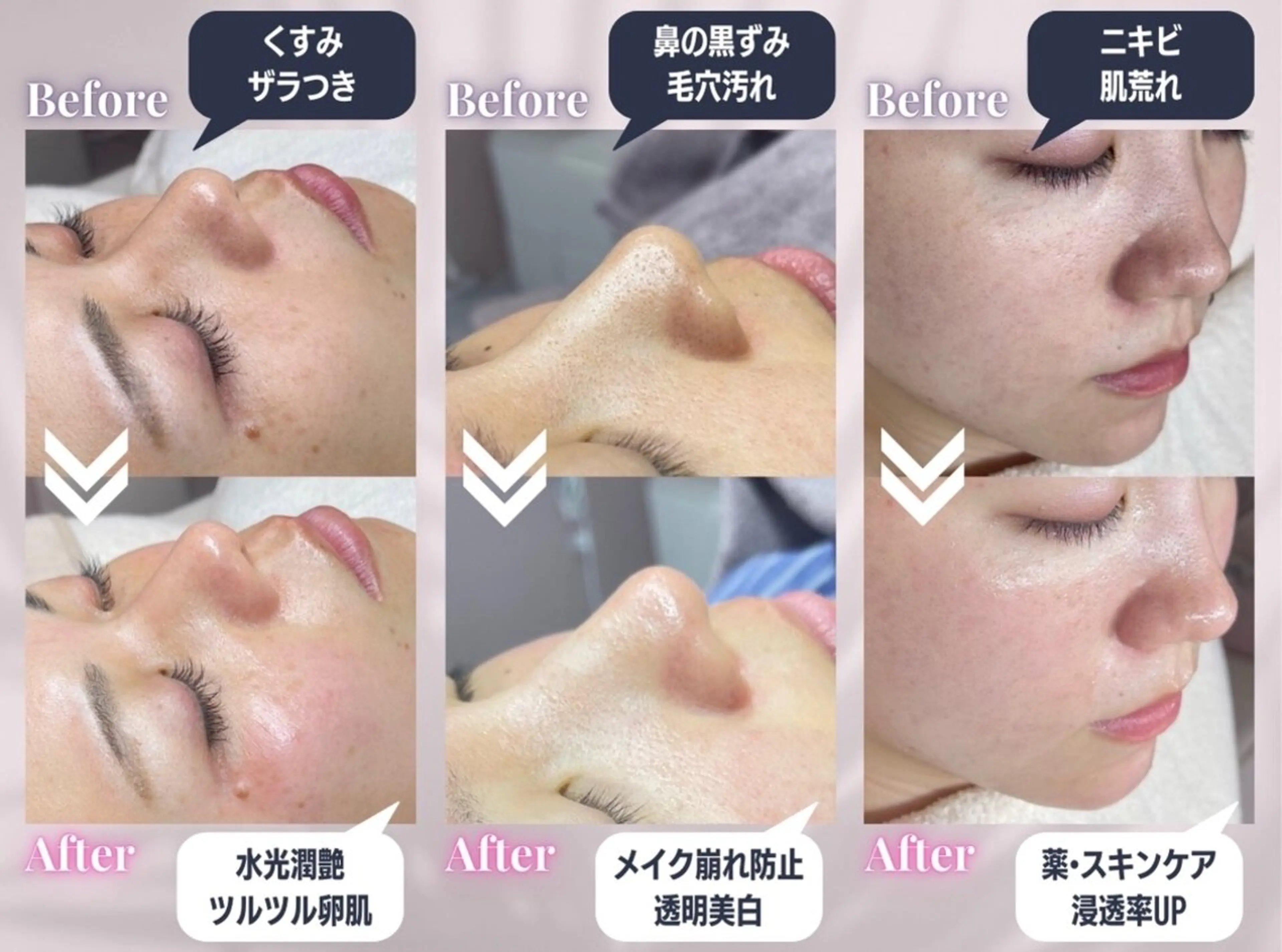 WhiteWax 堺東店所属・WhiteWax 堺東店のエステ・リラクイメージ