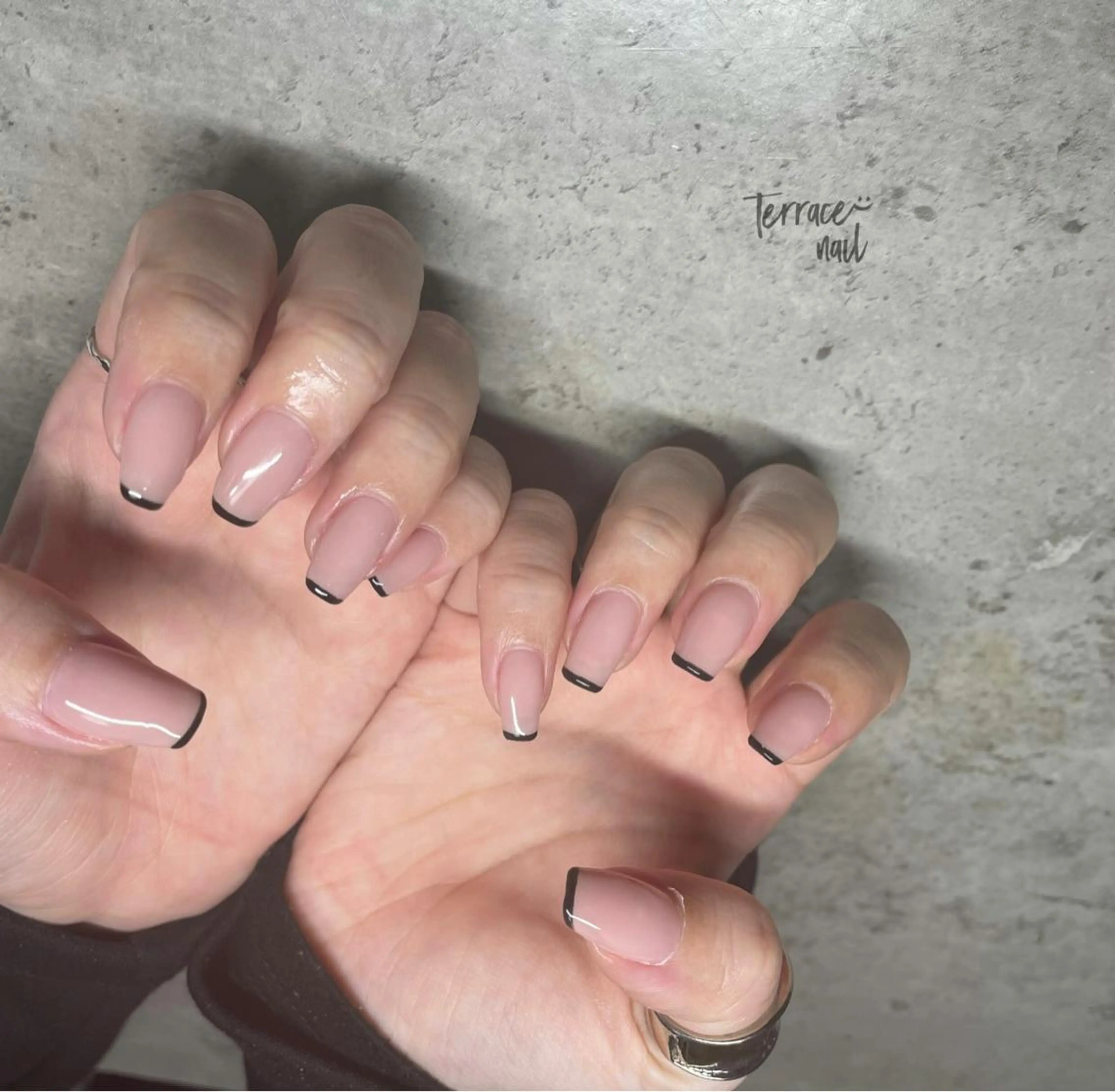 スキニーフレンチコース　オフ•ケア込みの写真