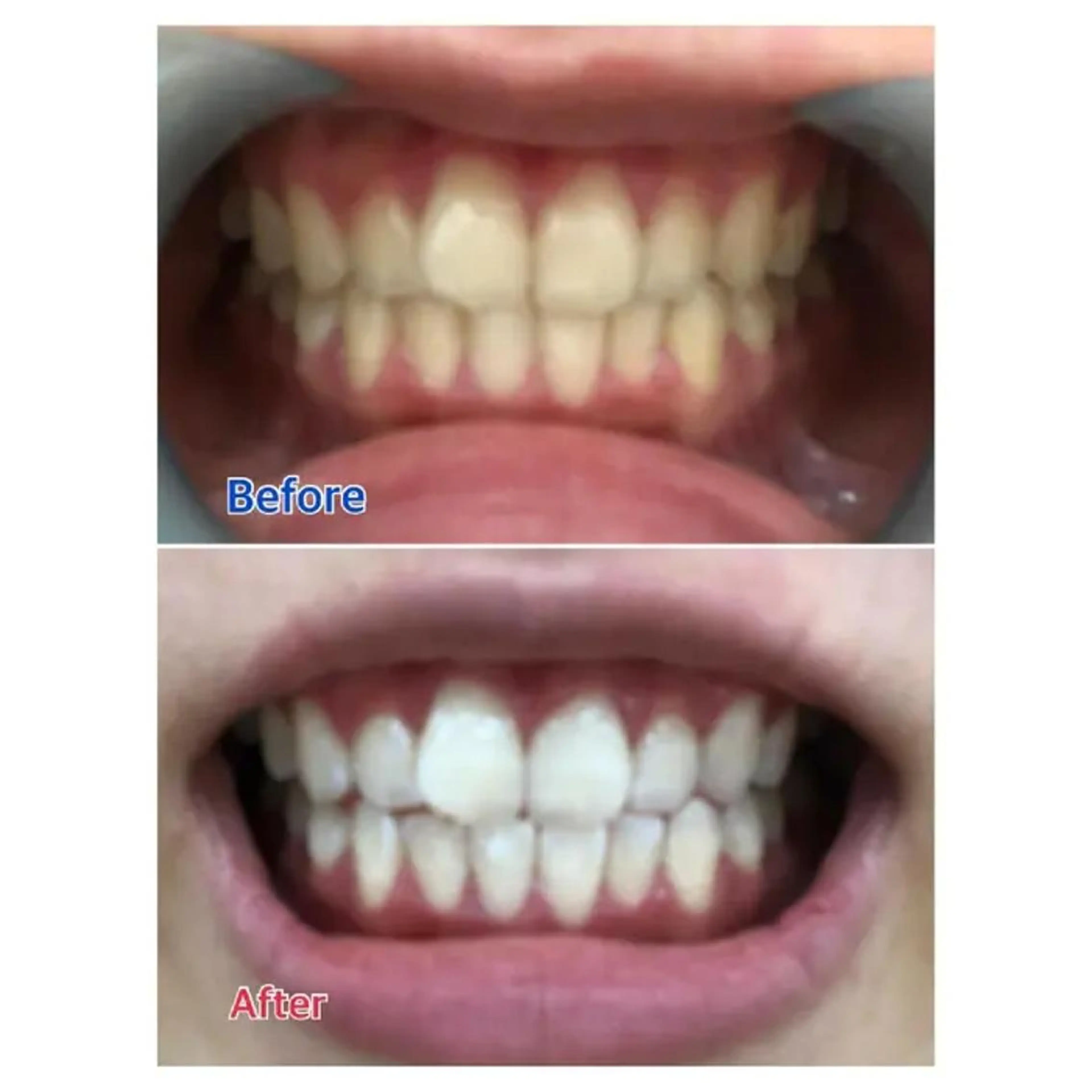 M渋谷店所属・M渋谷 ホワイトニングのエステ・リラクイメージ