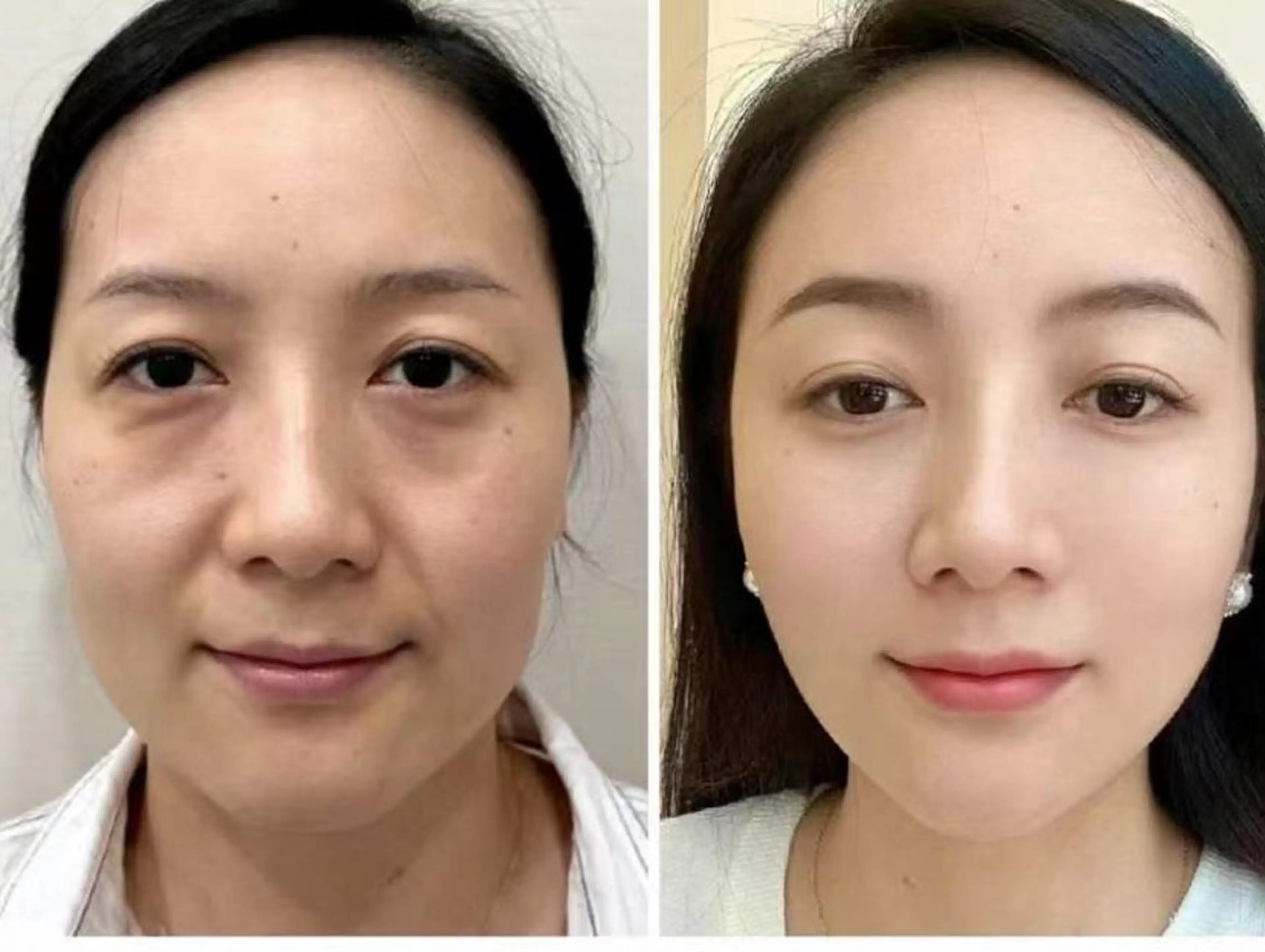 ネイル エステ aliaハイフ&水光ジェットサロン所属・aliaハーブ水光店 エステティシャン募集のエステ・リラクイメージ