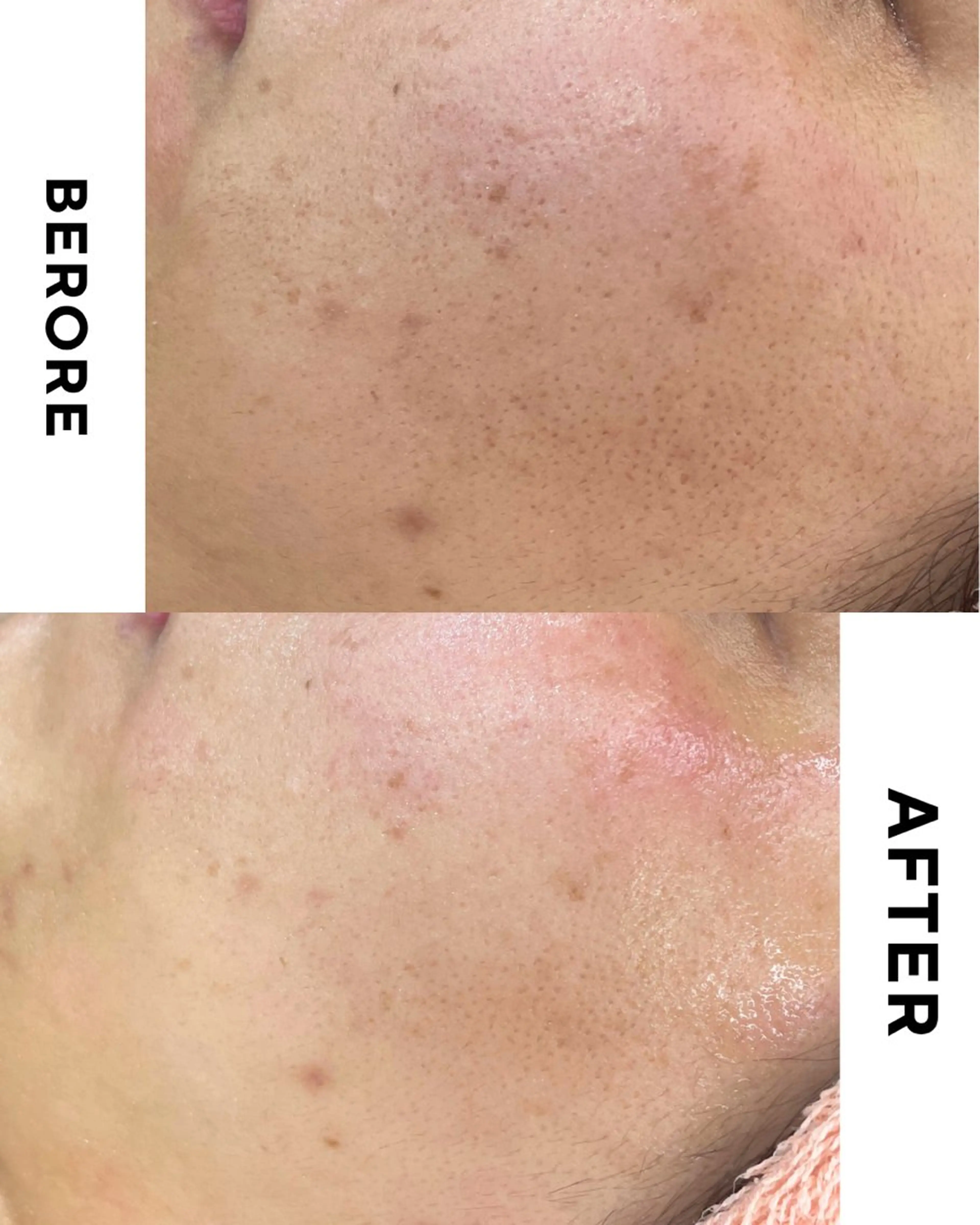 エステ 肌質改善専門サロン Bellmi/心斎橋のエステ・リラクイメージ