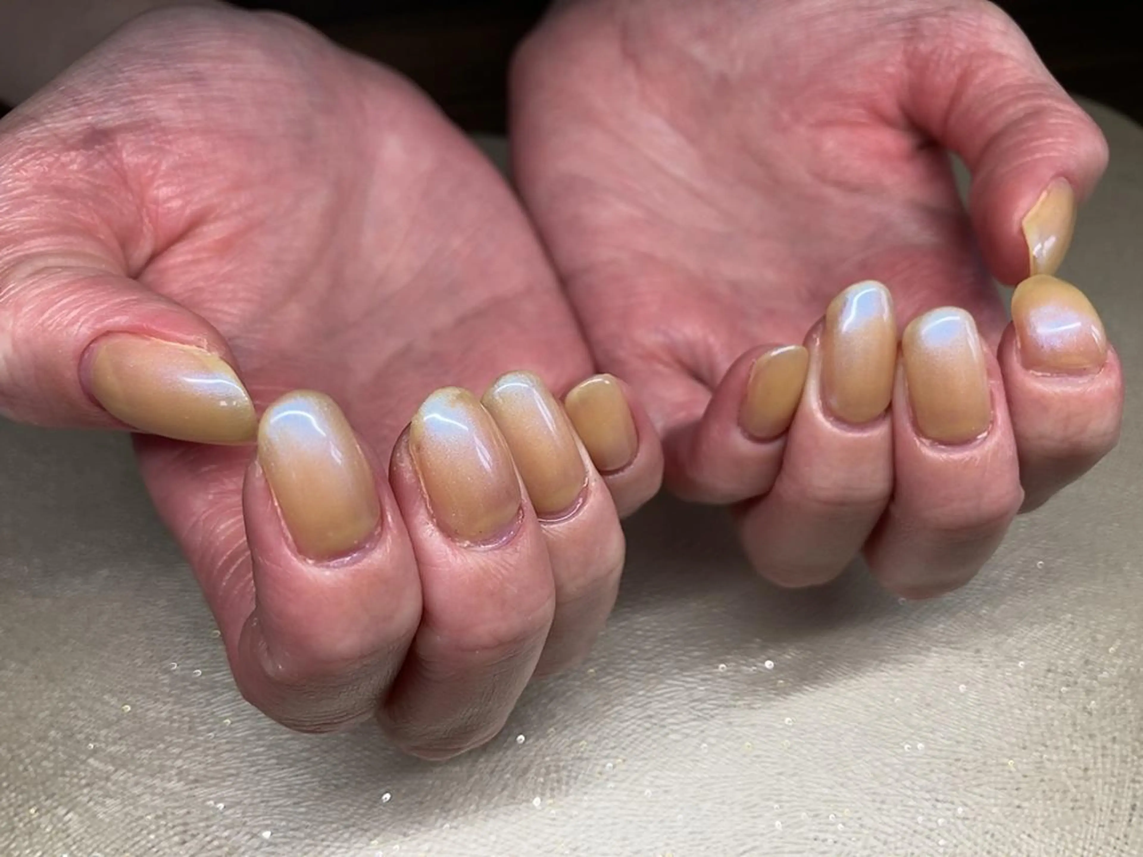 ネイル ハンドネイル 𝐴𝑁𝑈𝐸 トラブル爪育成専門のネイルデザイン