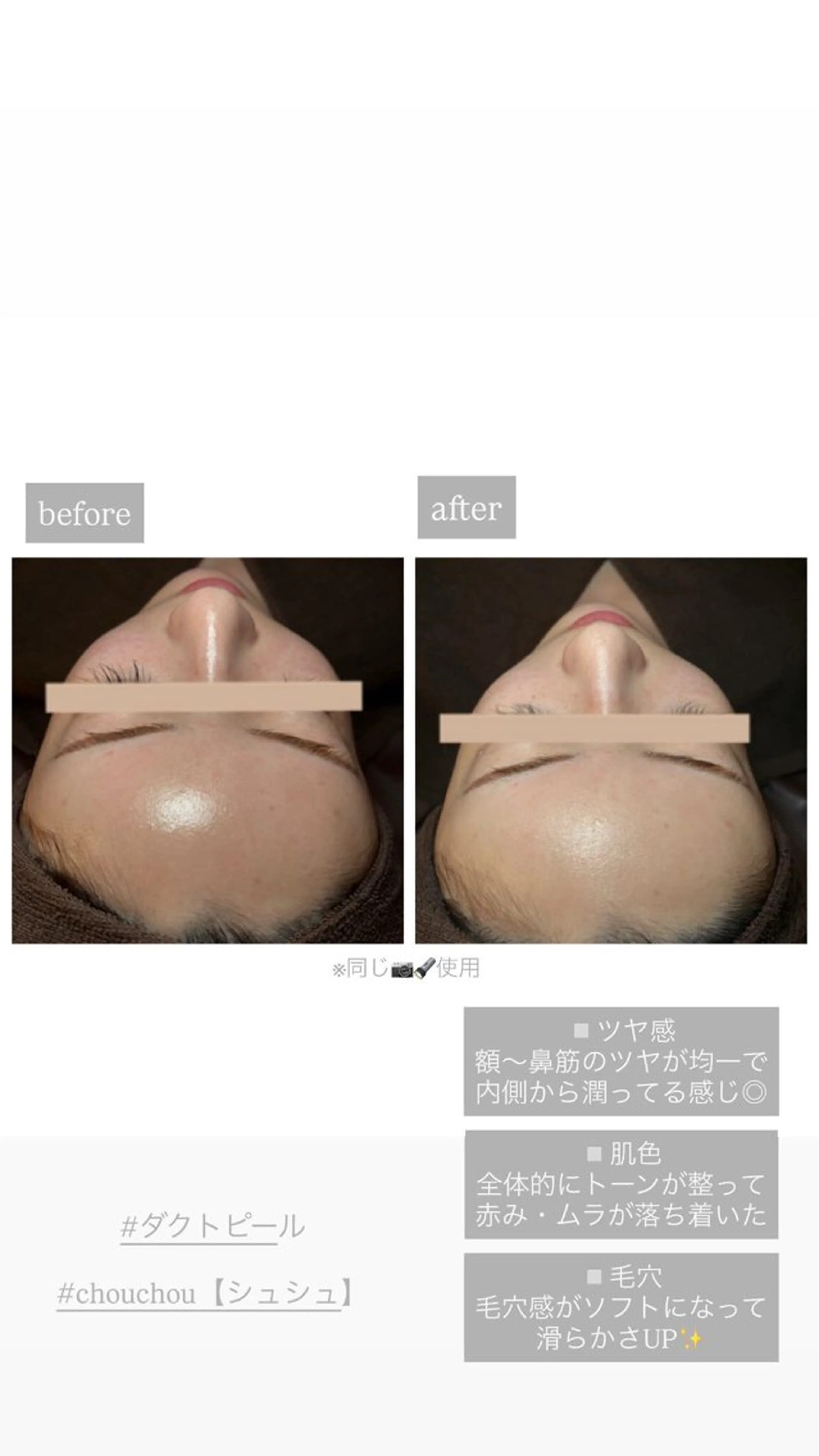 エステ chouchou所属・chouchou hayasaのエステ・リラクイメージ