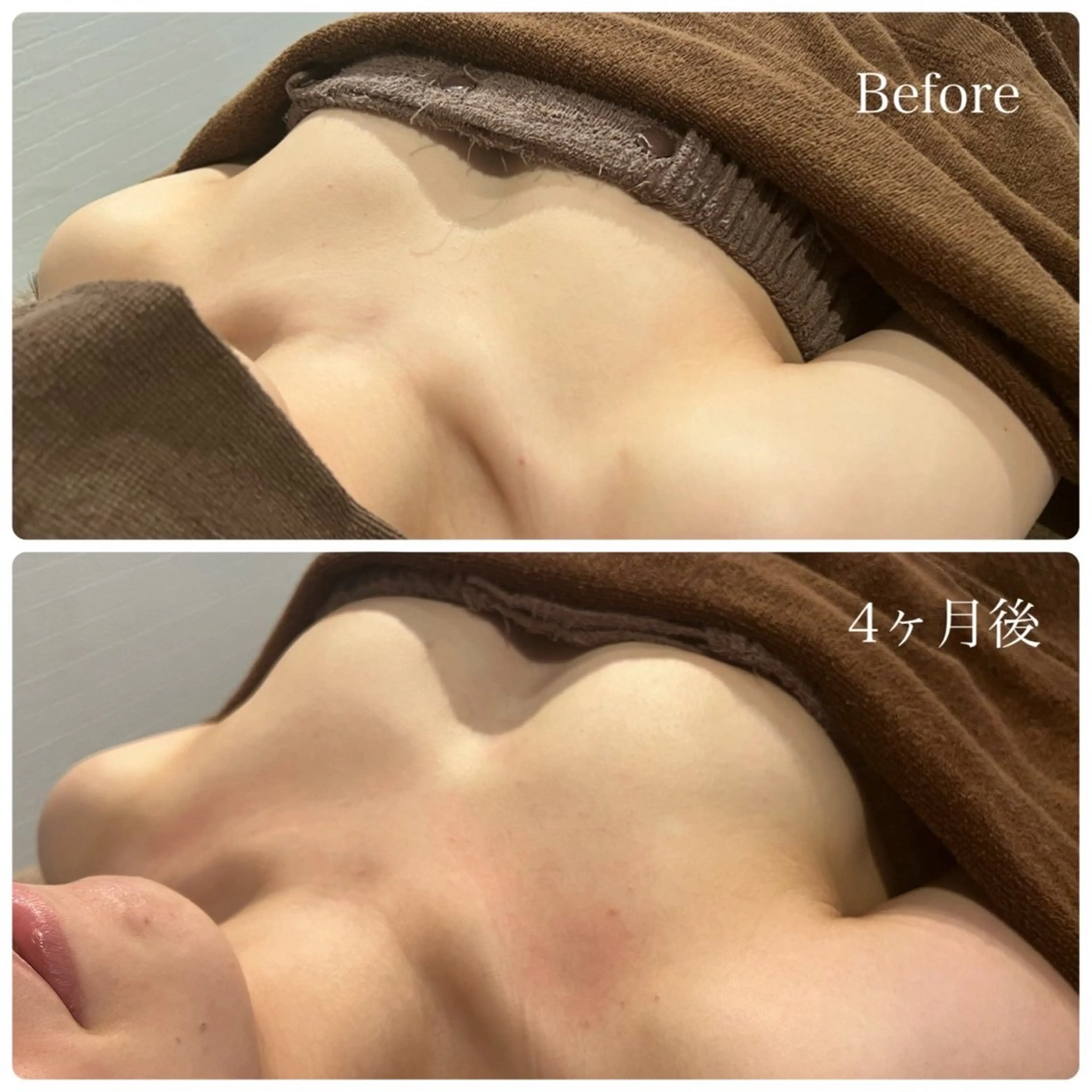 エステ Gemini MIKIのエステ・リラクイメージ