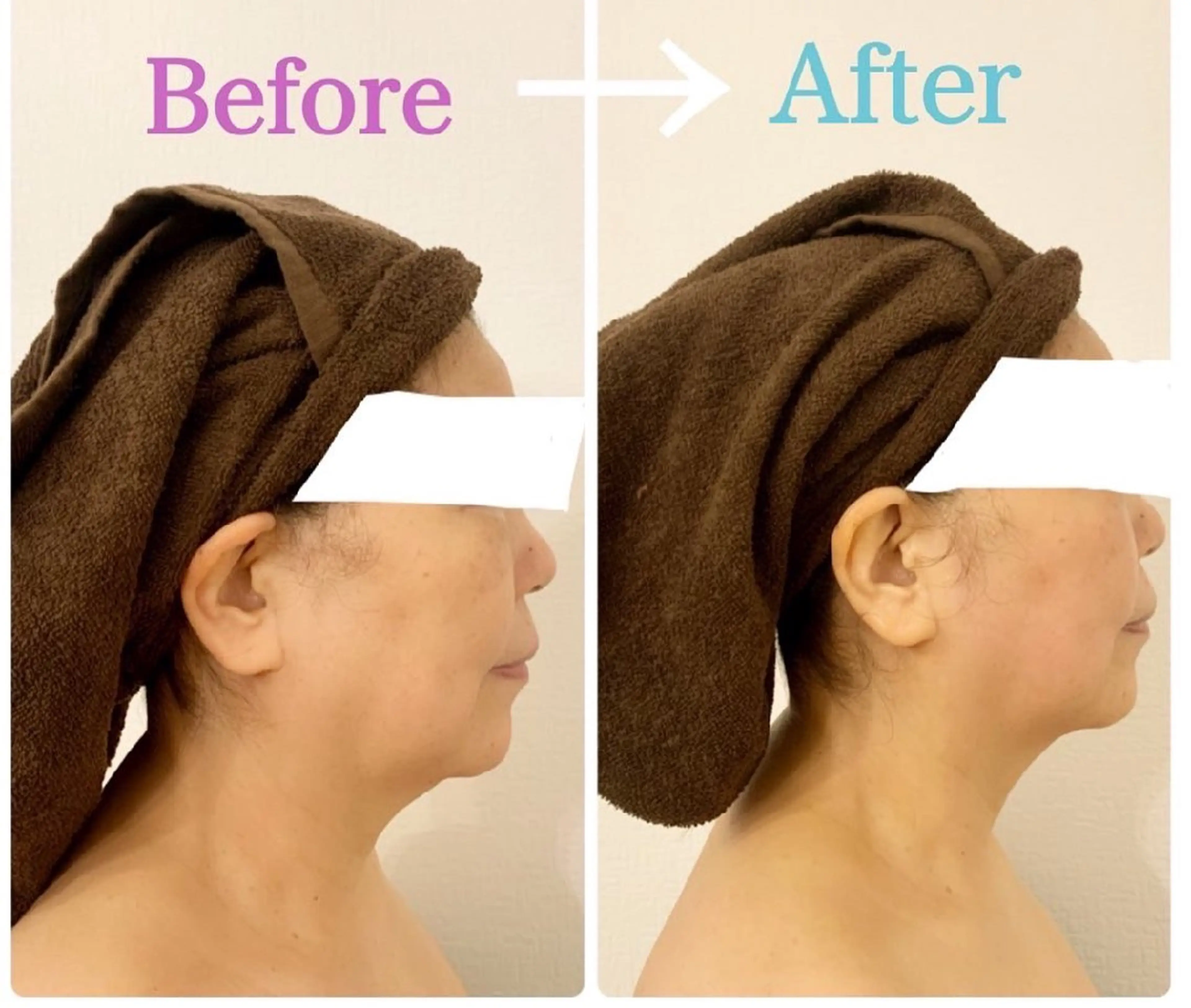 エステ Plume プリュムのエステ・リラクイメージ