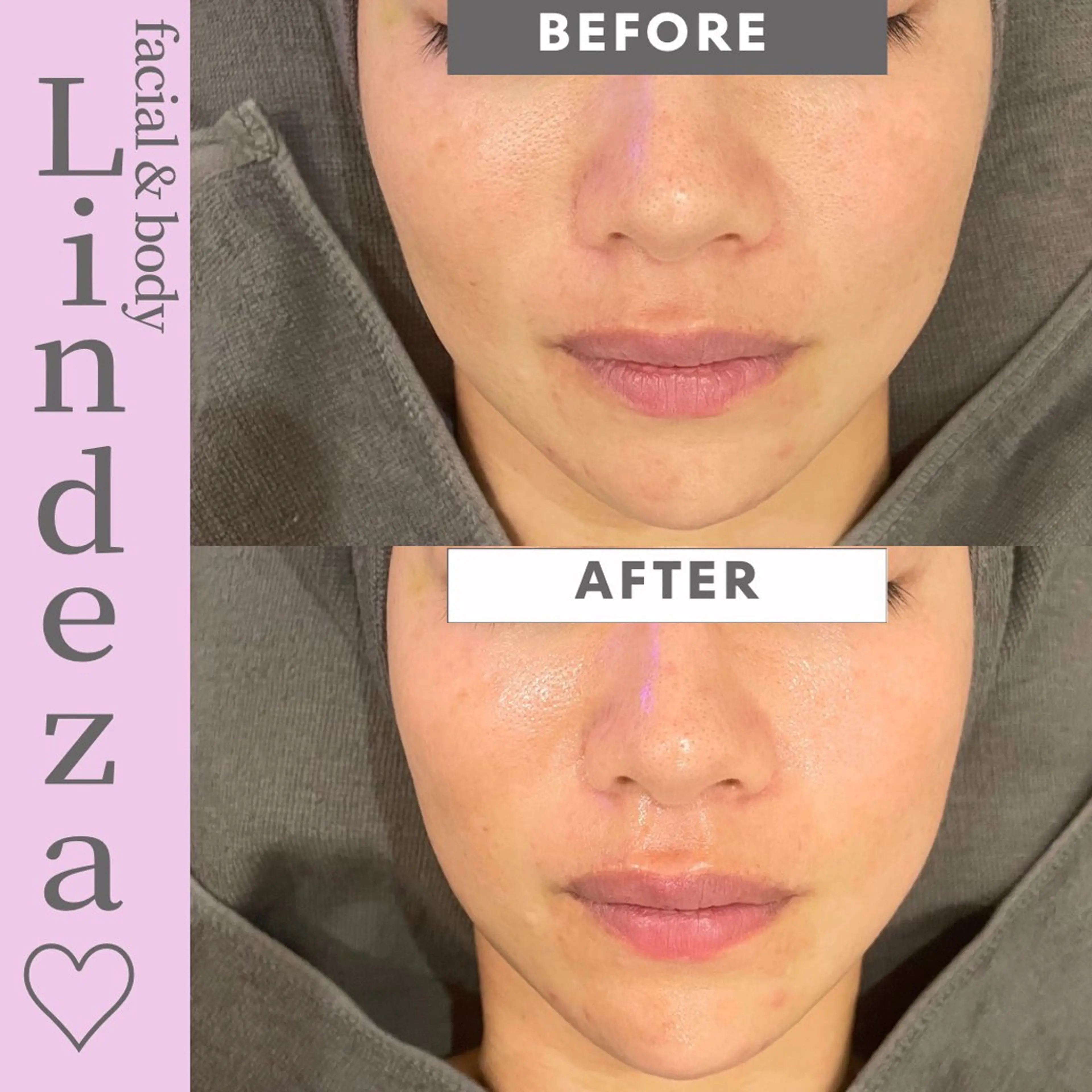 リンデザ 山口のエステ・リラクイメージ