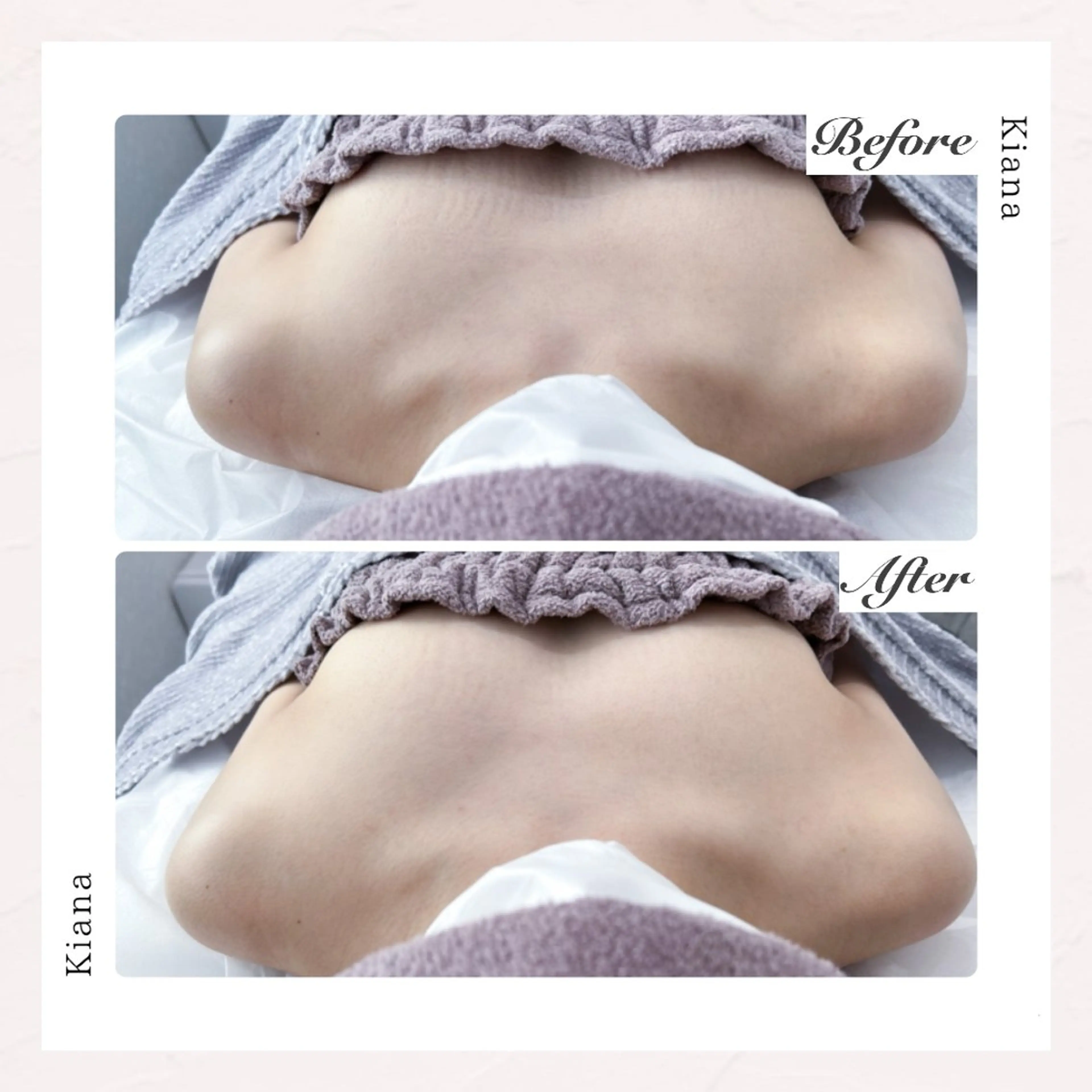 バスト専門Kiana 風のエステ・リラクイメージ