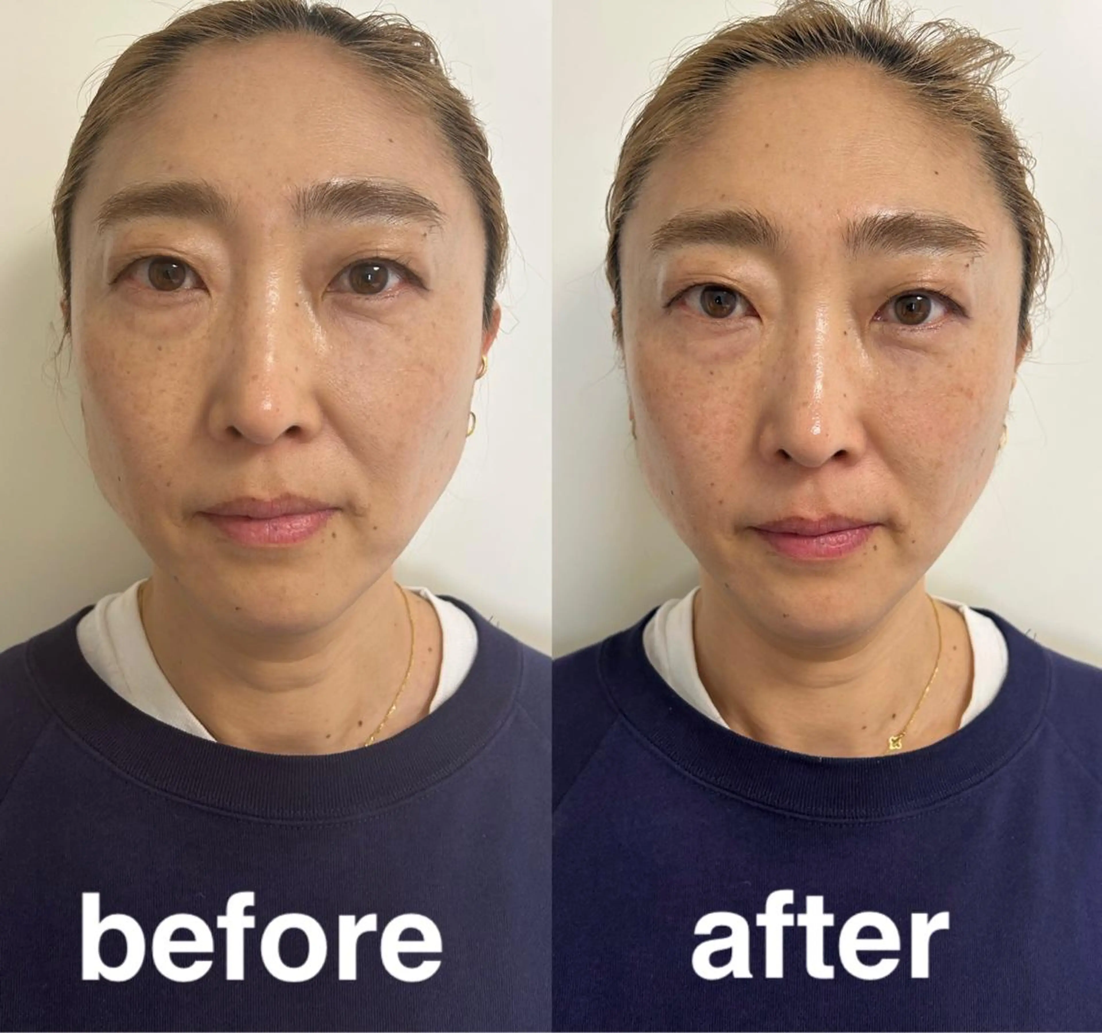 美容鍼灸サロン mahoroba院長のエステ・リラクイメージ