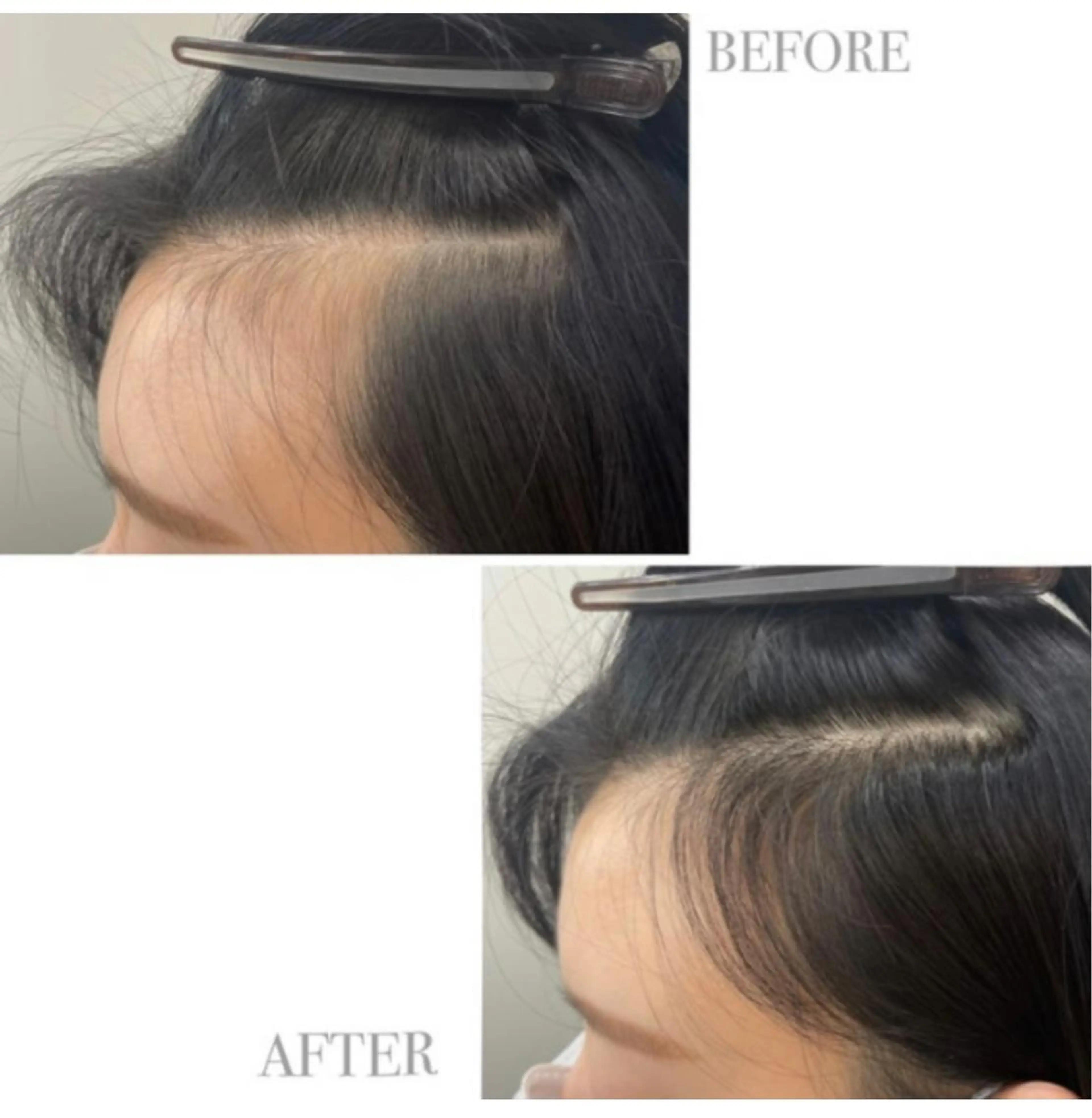 ミディアム パーマ Manami ♡のヘアスタイル