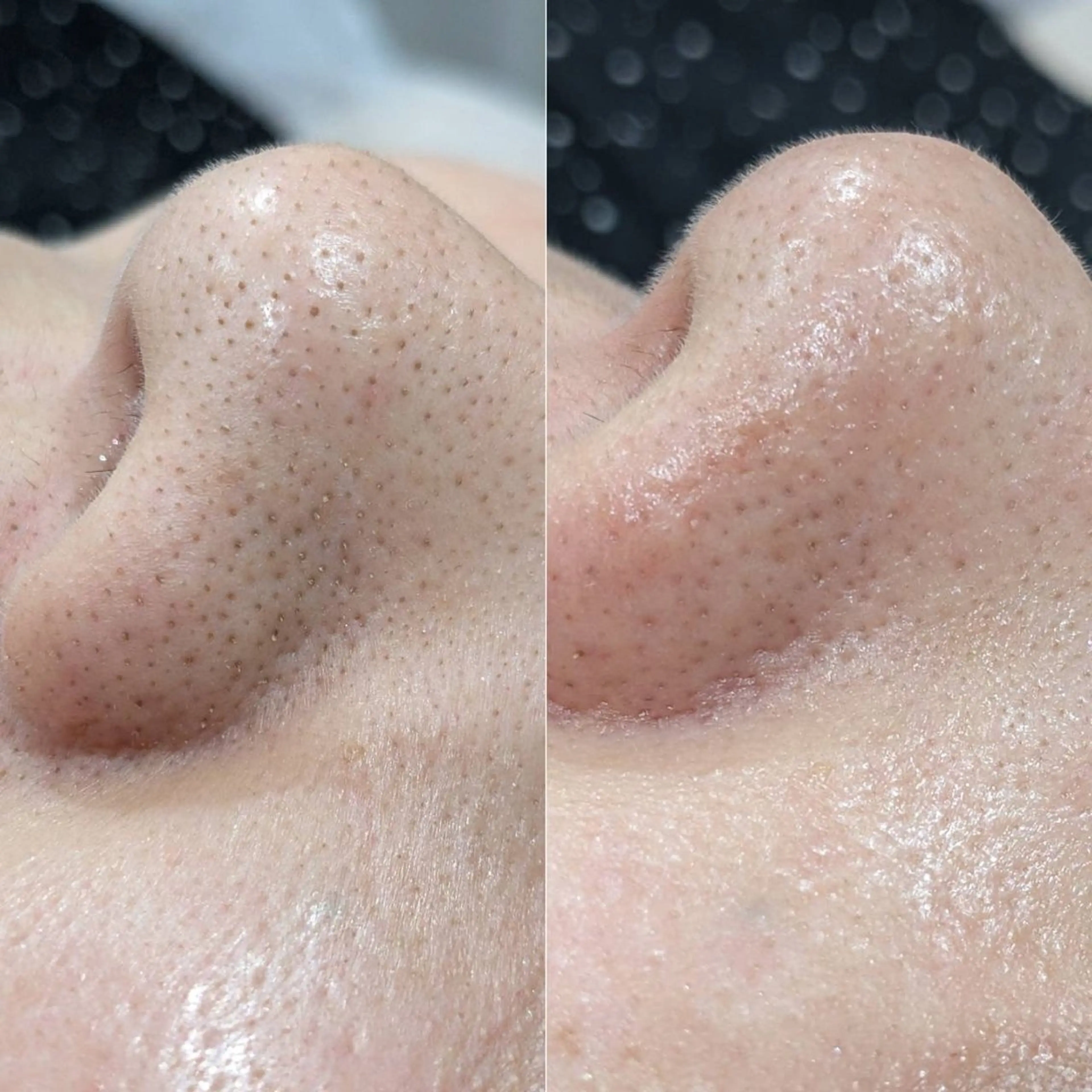 fors 梅田所属・saki 束感まつ毛/ 大阪のマツエク・マツパデザイン