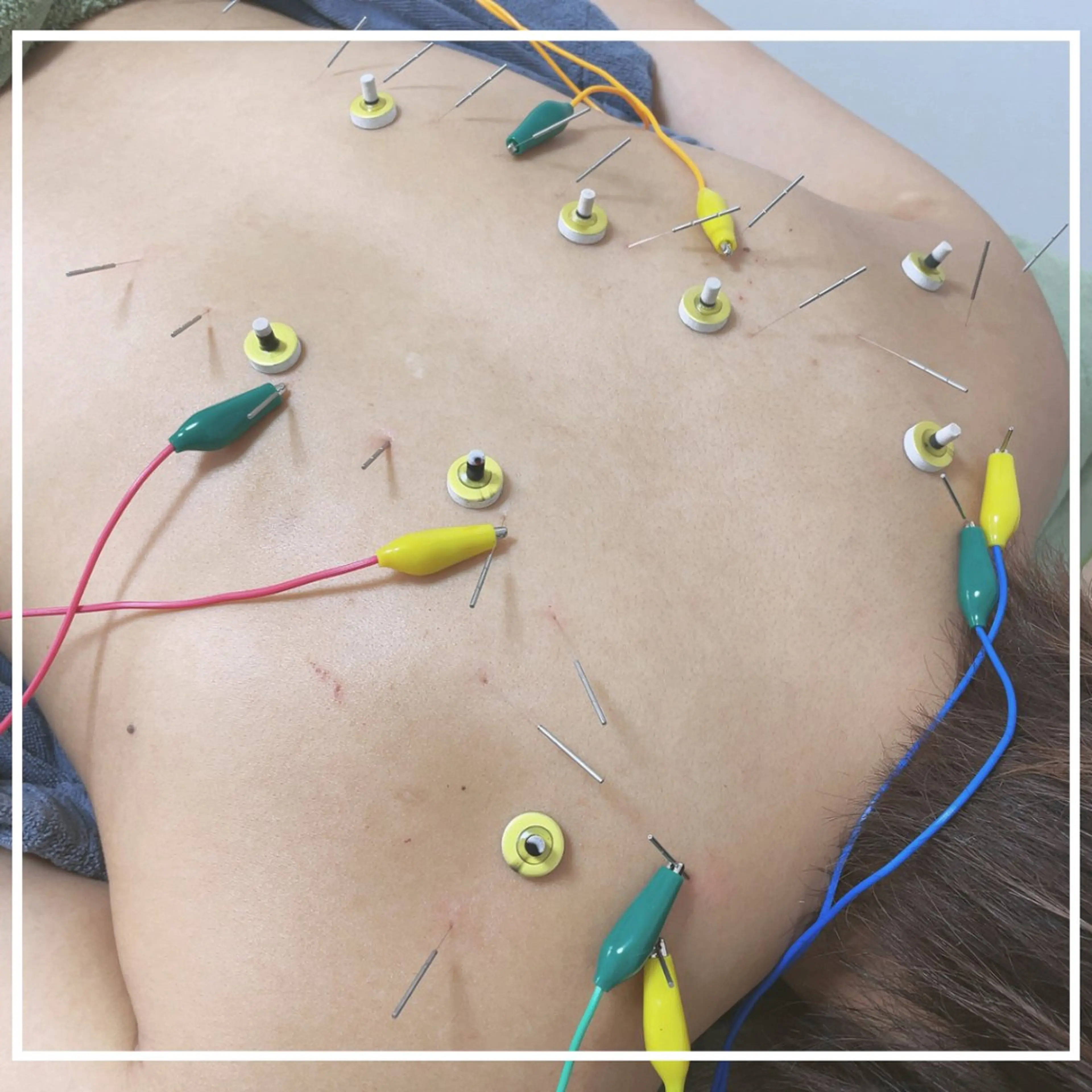 美容鍼灸サロン   colorier所属・美容鍼灸サロン colorierのエステ・リラクイメージ