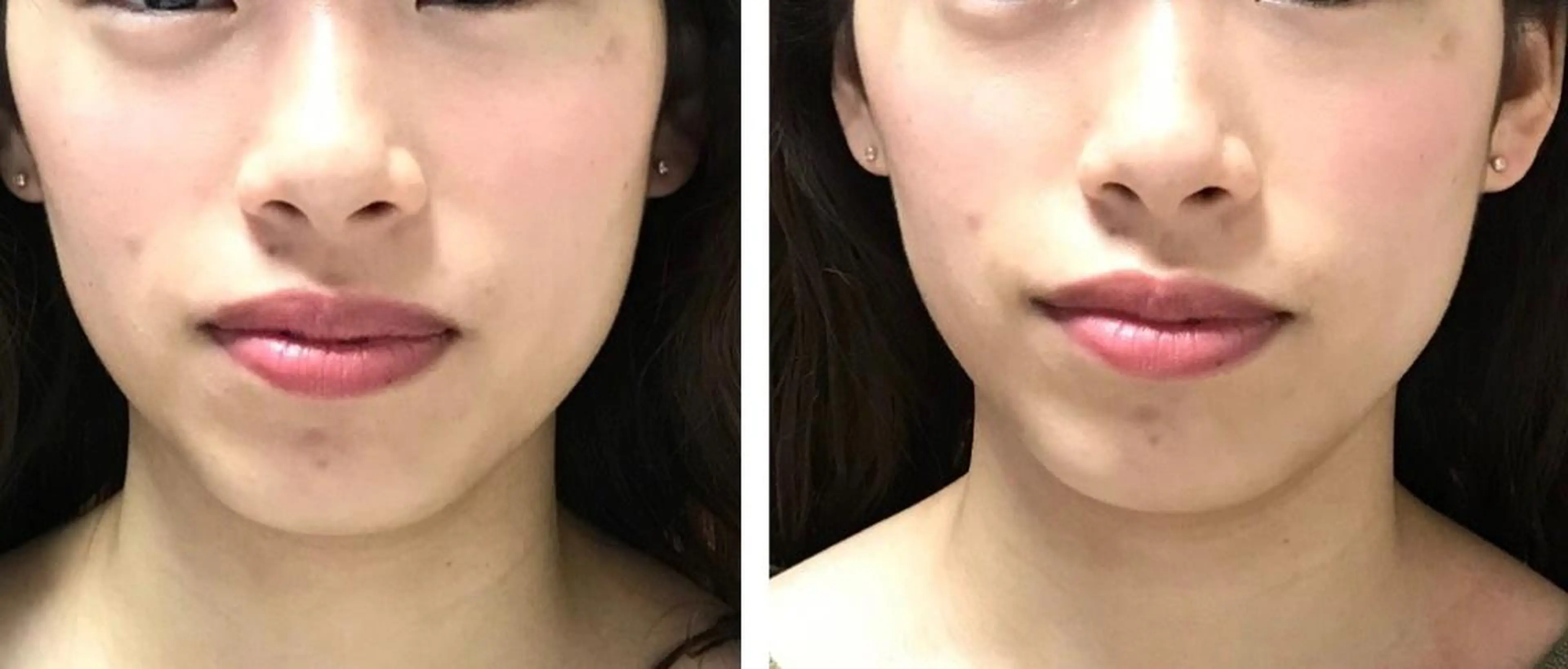 salon.plaisir（プレズィール）所属・酒井 瑠未のエステ・リラクイメージ