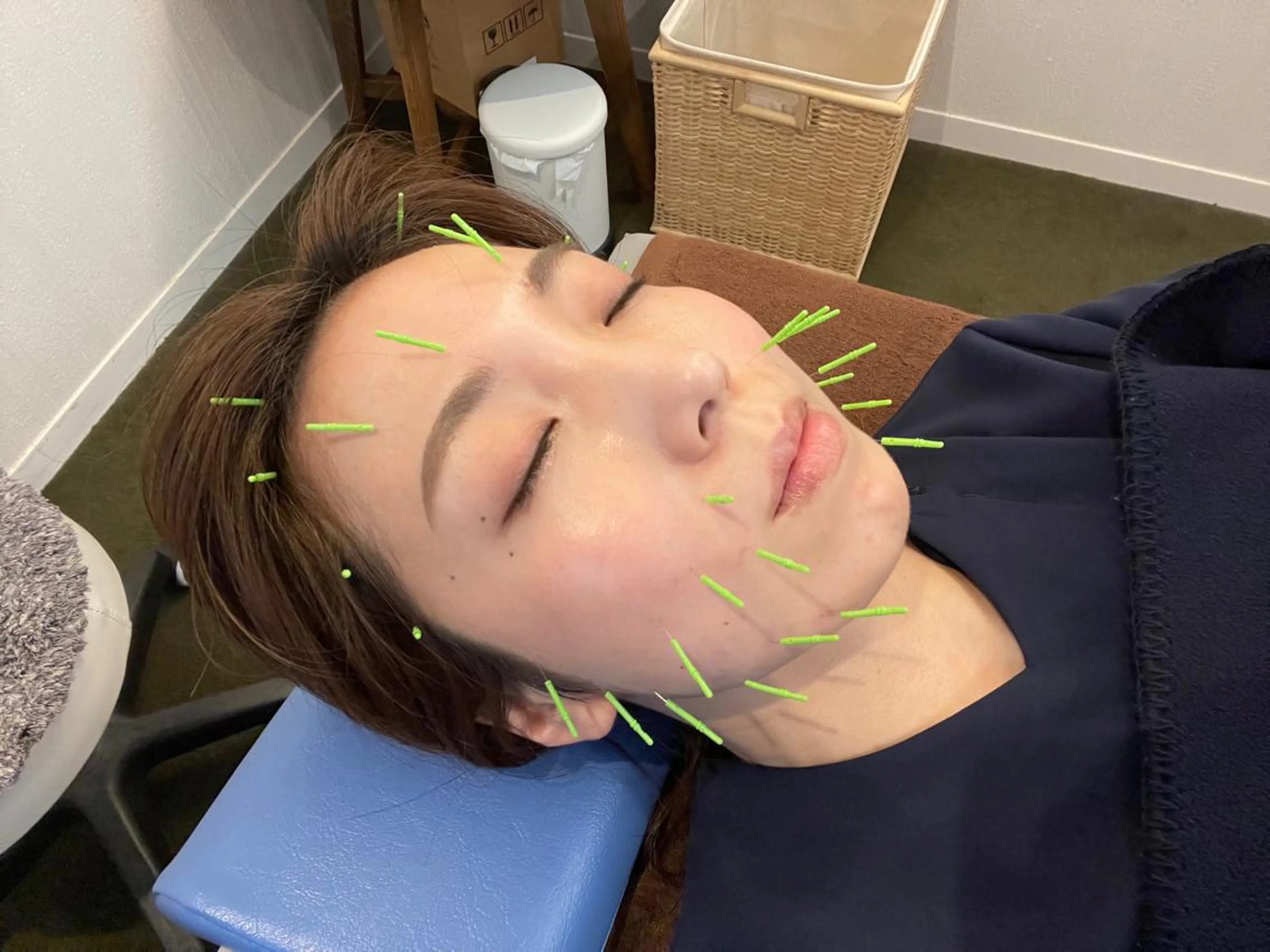 美容鍼　蒼月-aotsuki-所属・美容鍼「蒼月」 -アオツキ-のエステ・リラクイメージ