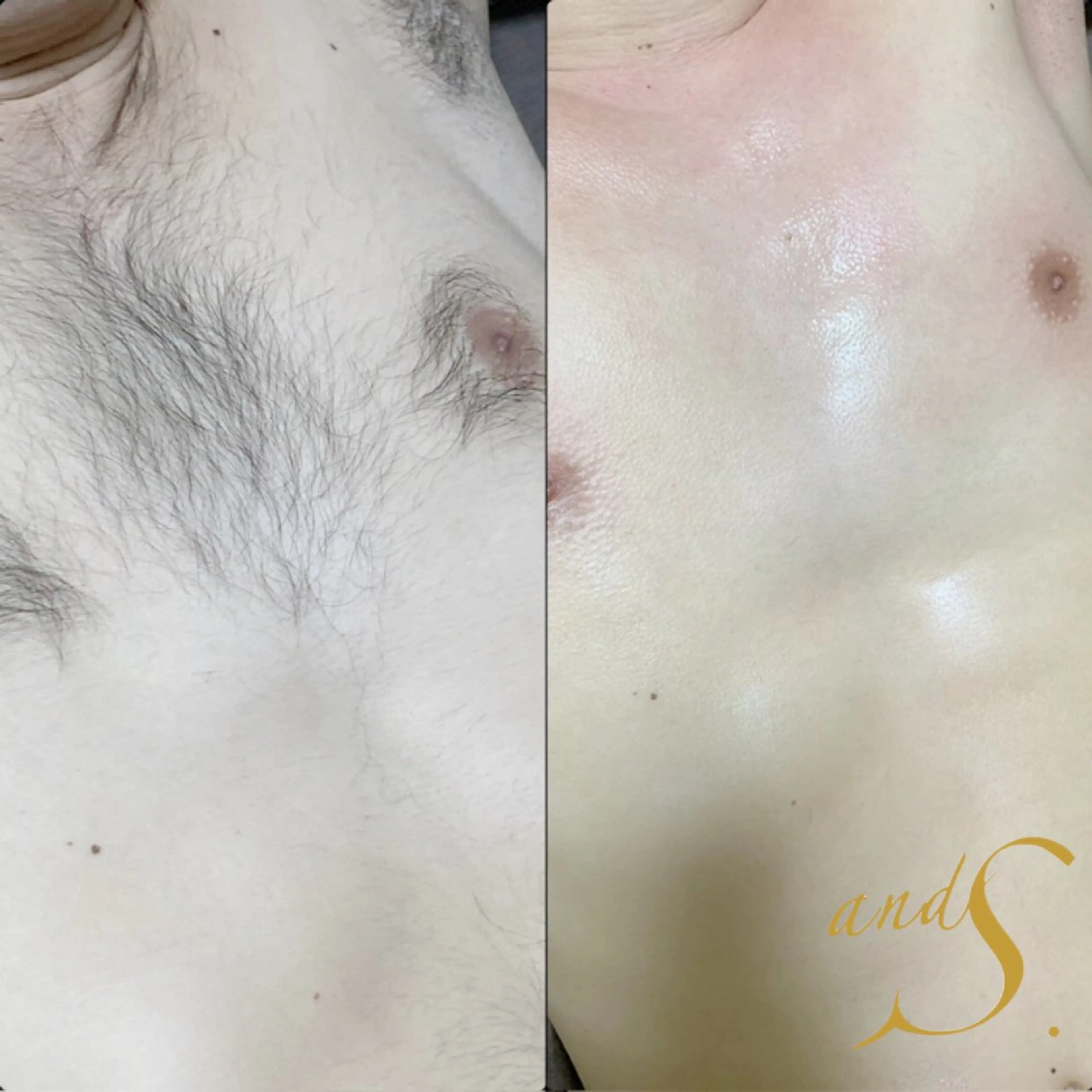 メンズ 🌸🧡六本木 脱毛しずか🧡🫧の眉毛・アイブロウイメージ