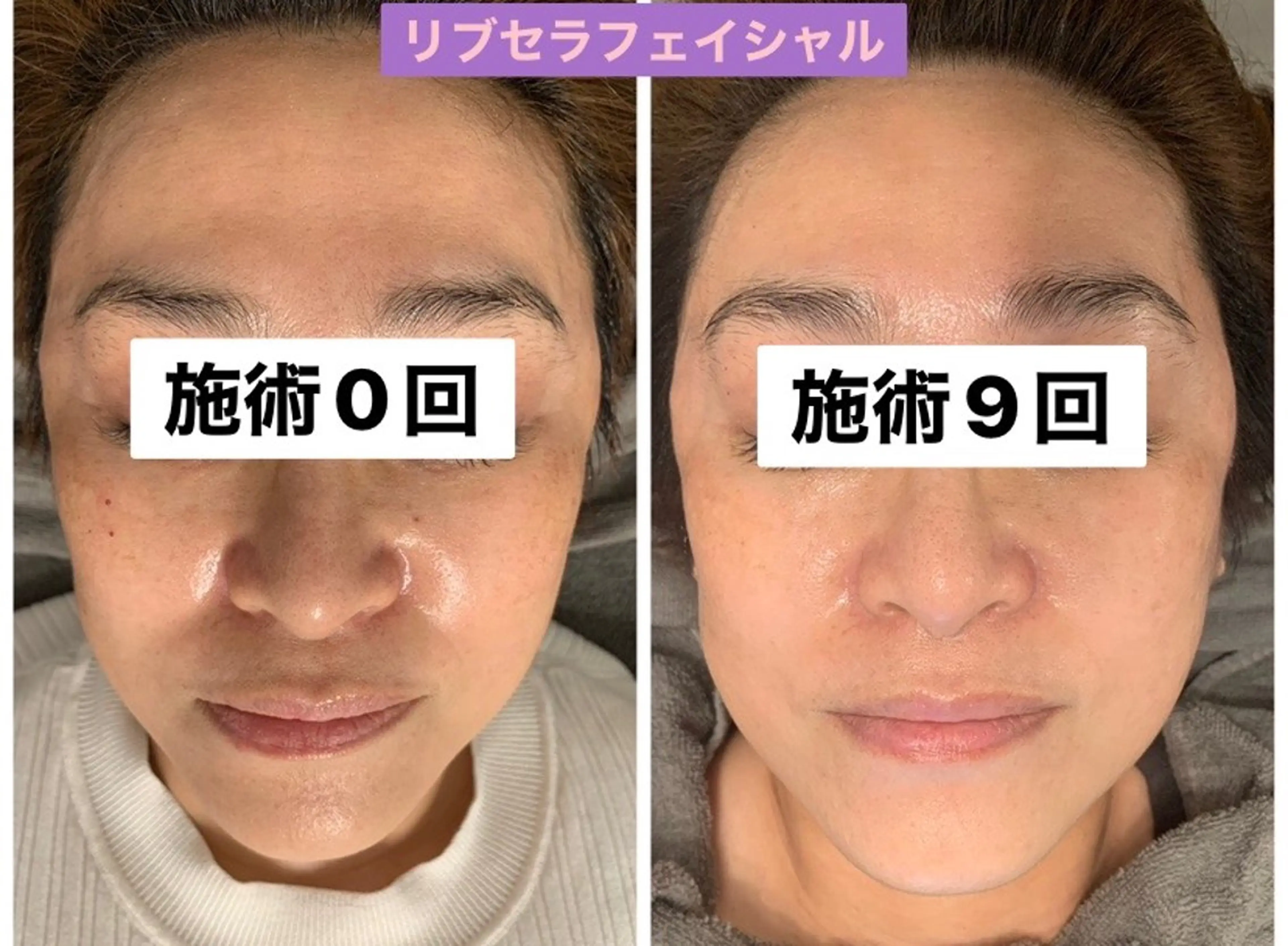 エステ Private Salon Prunelle所属・プライベートサロン プリュネルのエステ・リラクイメージ