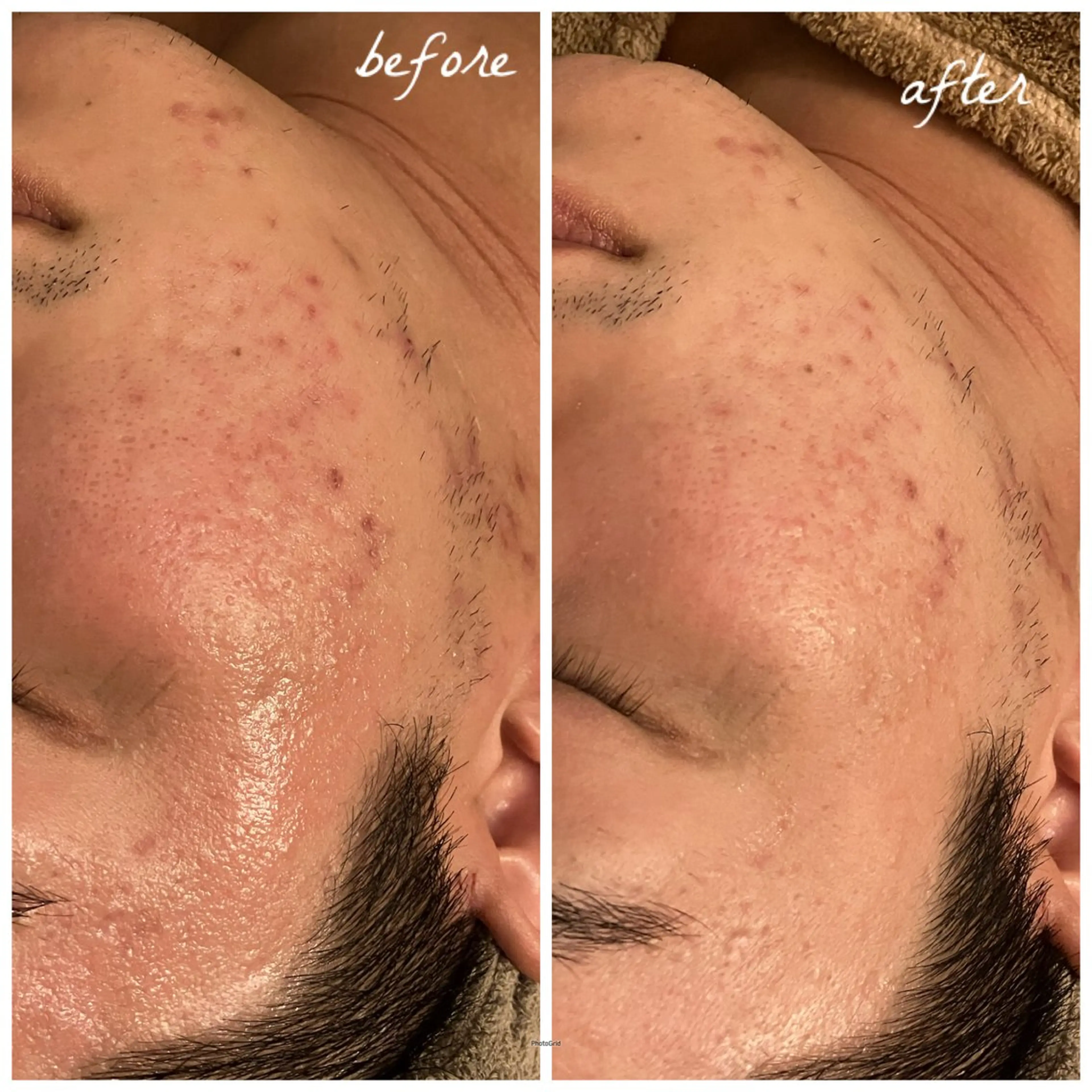 メンズ メナード岐阜茜部 杉浦のエステ・リラクイメージ