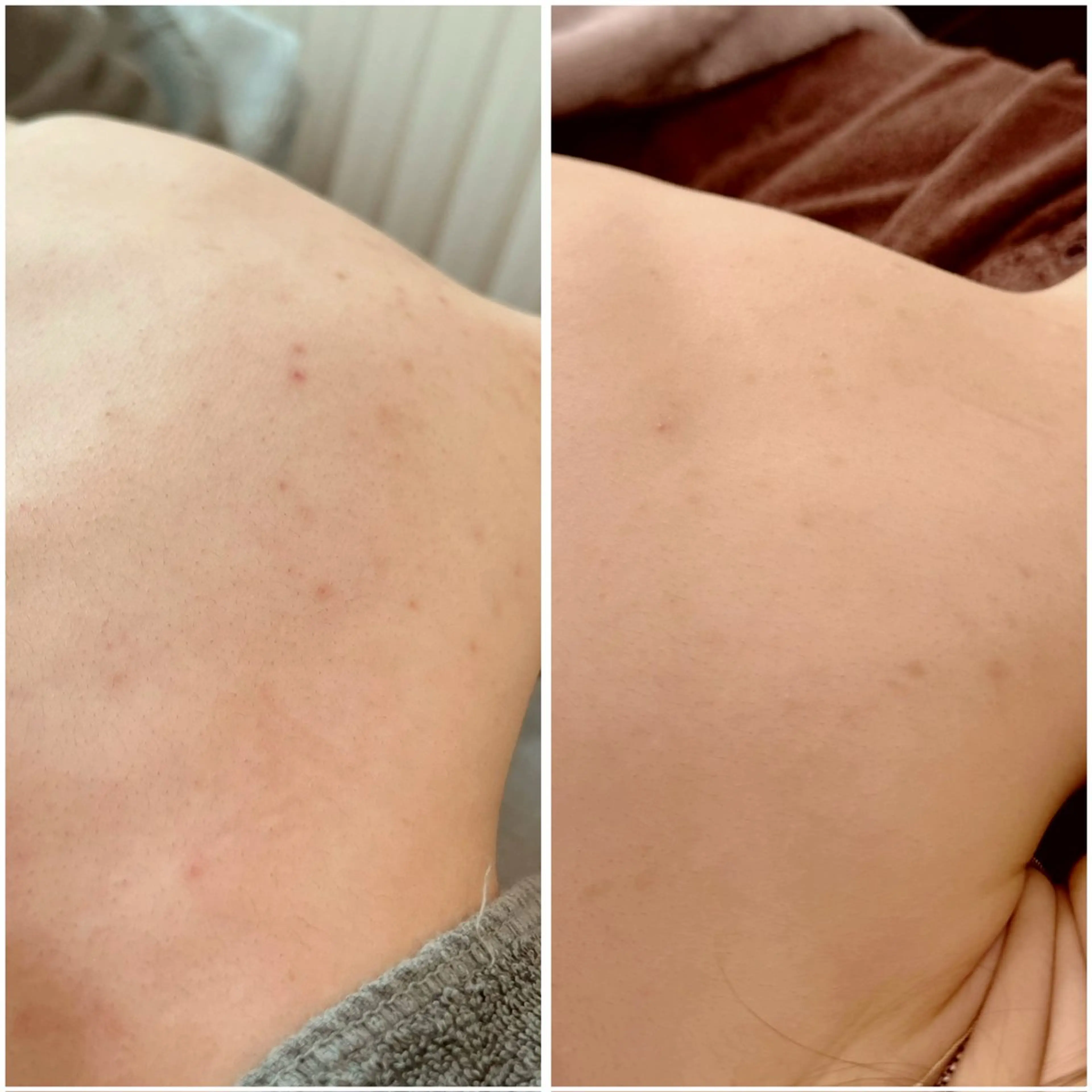 foi sayaのエステ・リラクイメージ