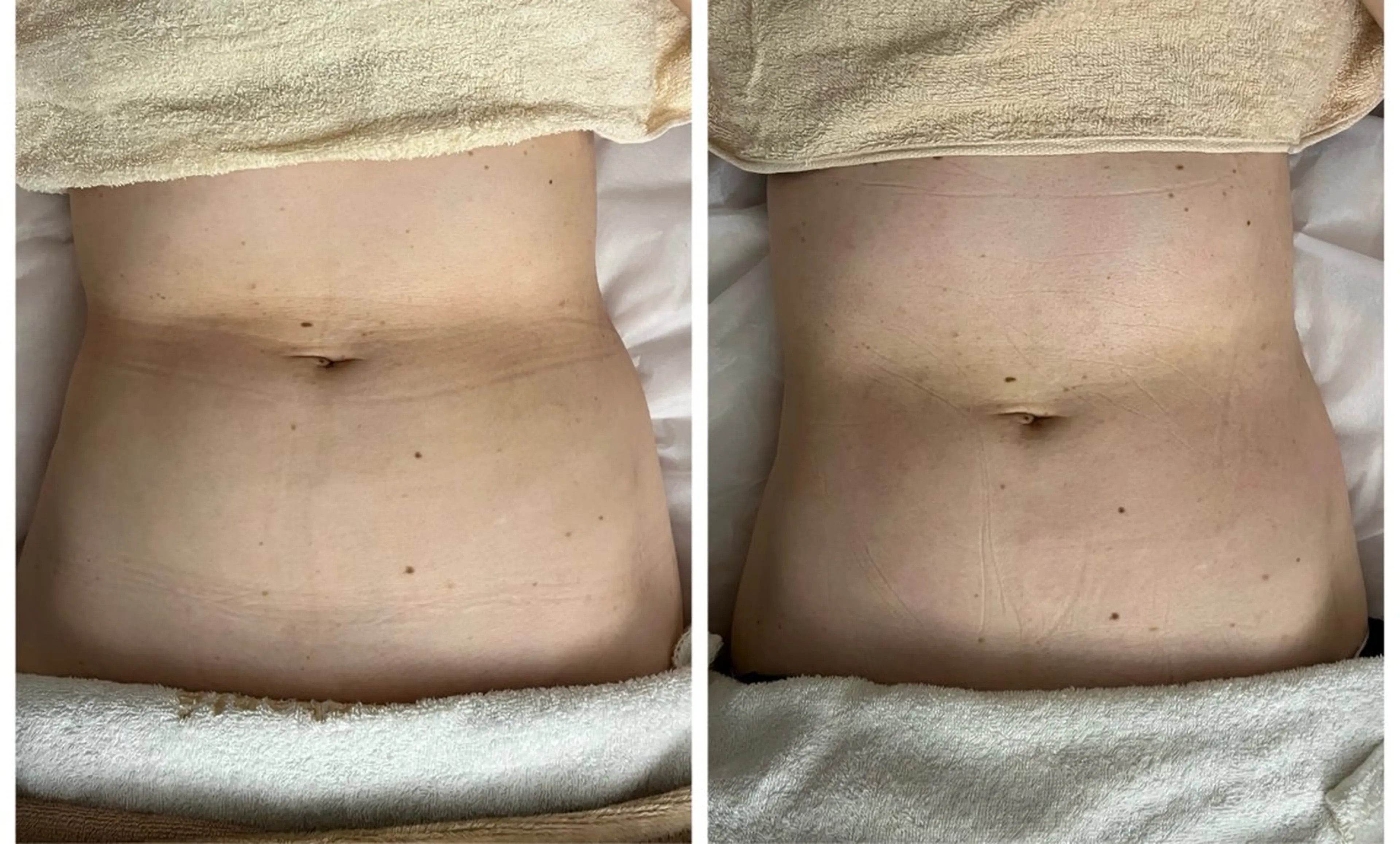 solo tu  salon MANA所属・美肌＆痩身＆脱毛 MANAのエステ・リラクイメージ