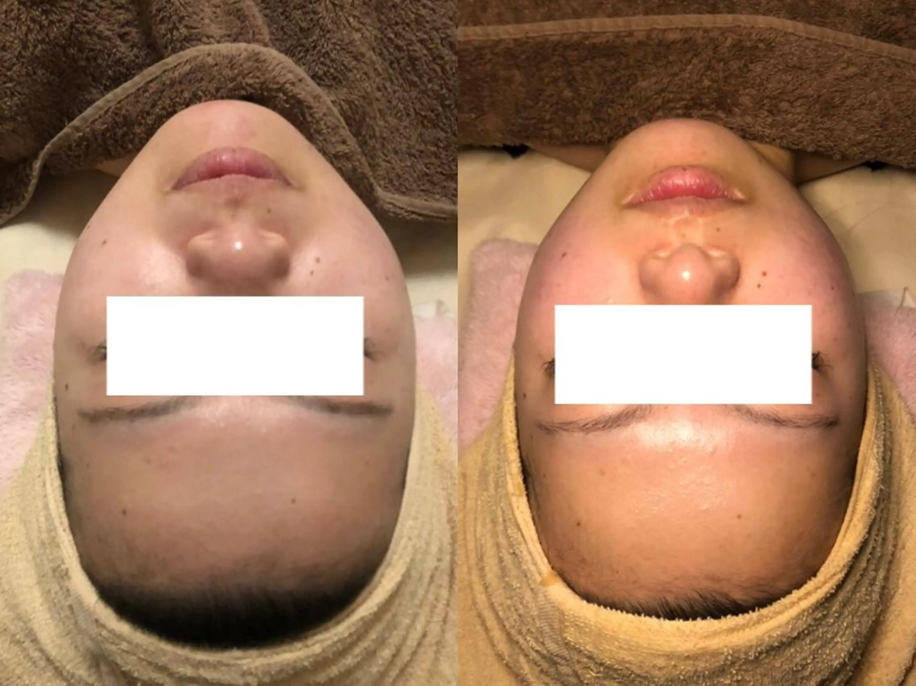 a  room salonのエステ・リラクイメージ