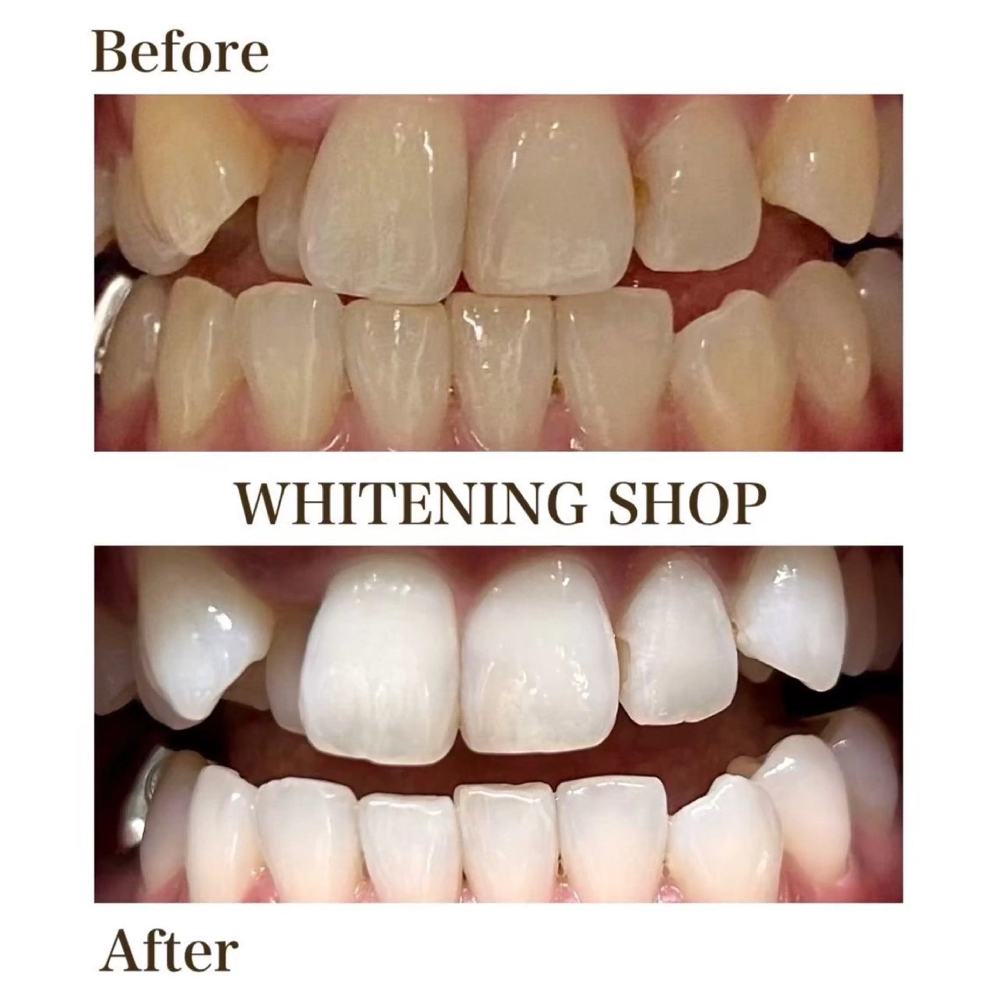 ホワイトニングショップ伊丹店所属・ホワイトニング ショップ伊丹店のその他イメージ