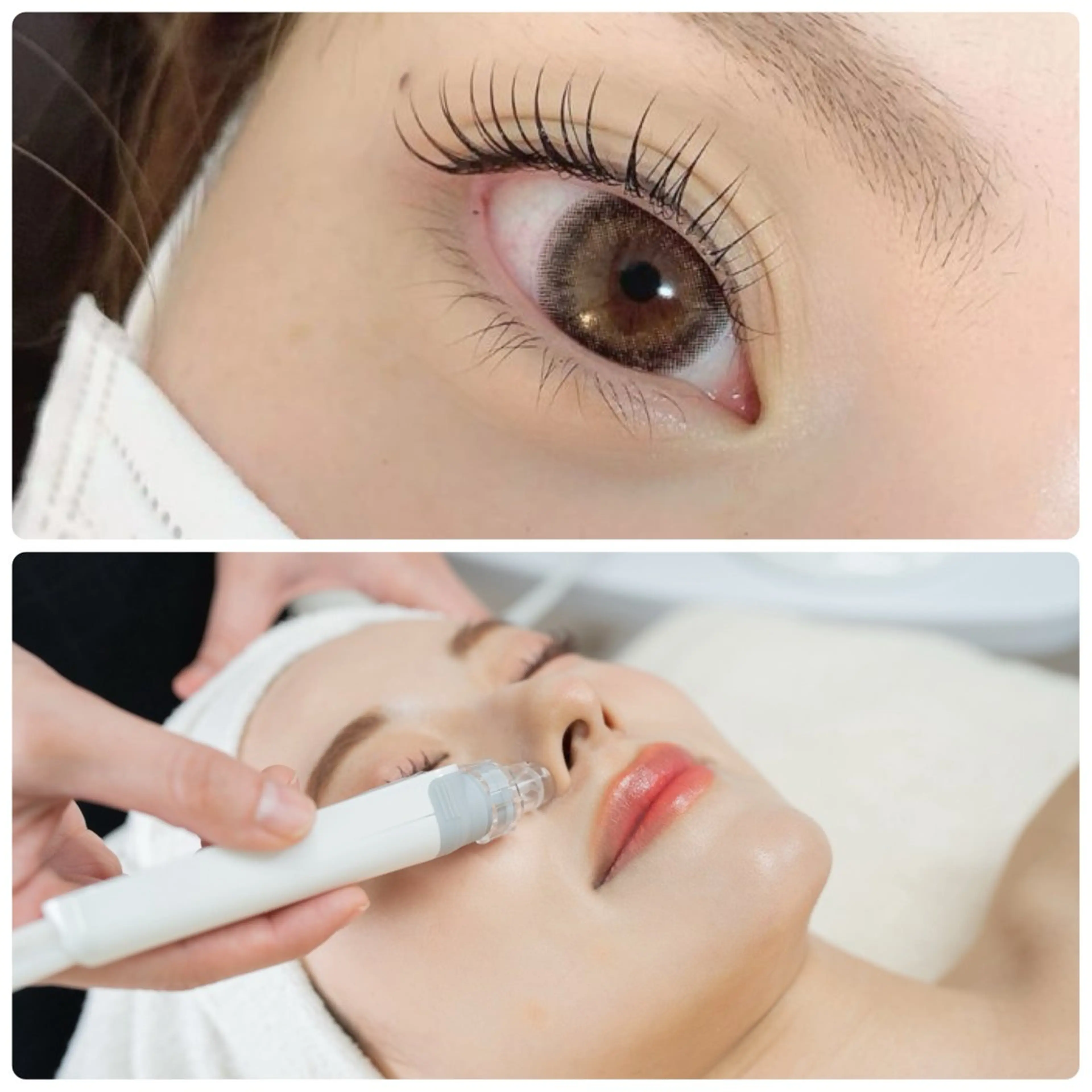 【まつげパーマ×水光マイルドピール】美肌ケア垢抜けセット✨11,550円→ 8,800円の写真