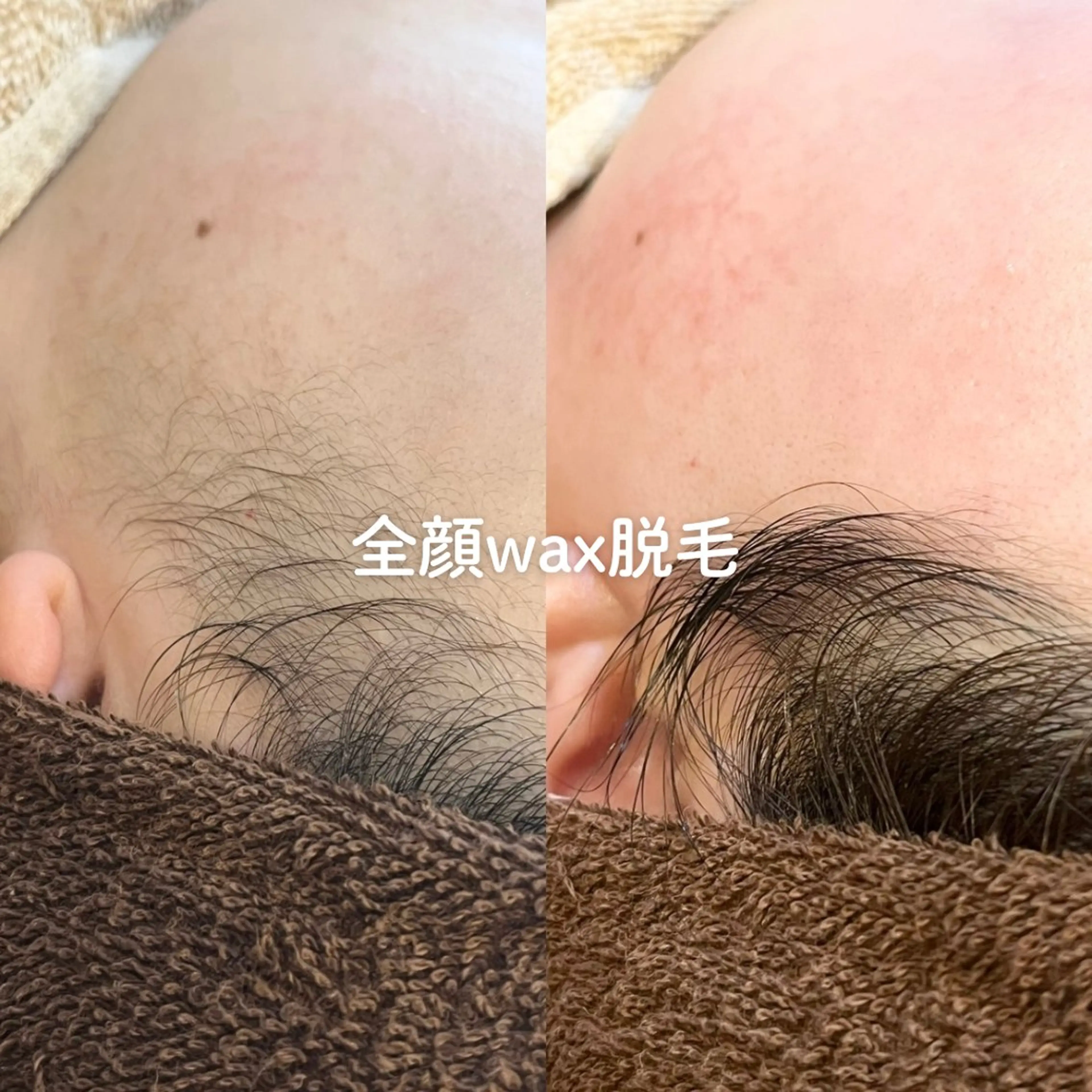 EST BEAUTY所属・顔ワックス脱毛/ ハーブピーリングのエステ・リラクイメージ