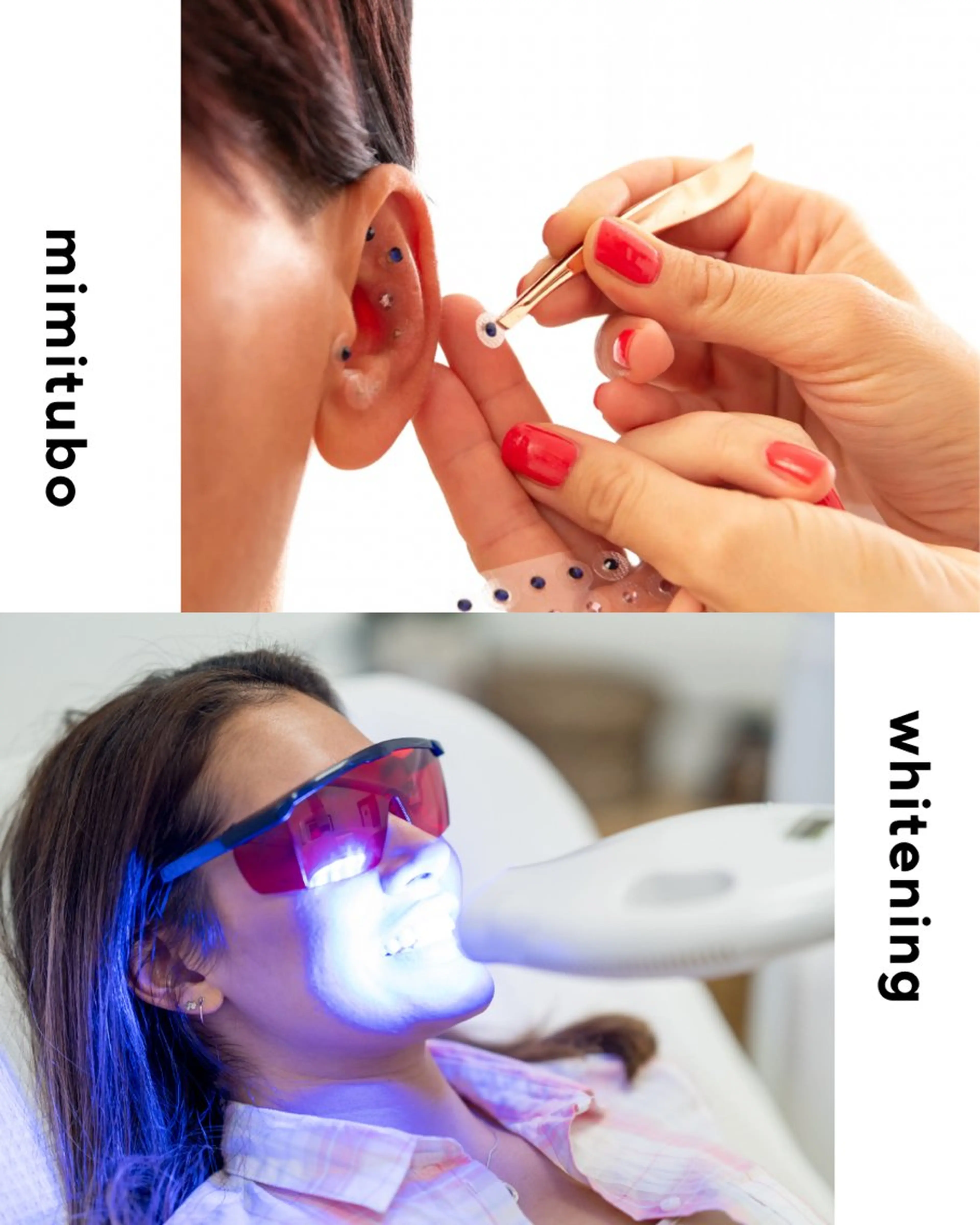 【耳つぼ+ホワイトニング】耳つぼジュエリー両耳10粒+ホワイトニング8分×2の写真