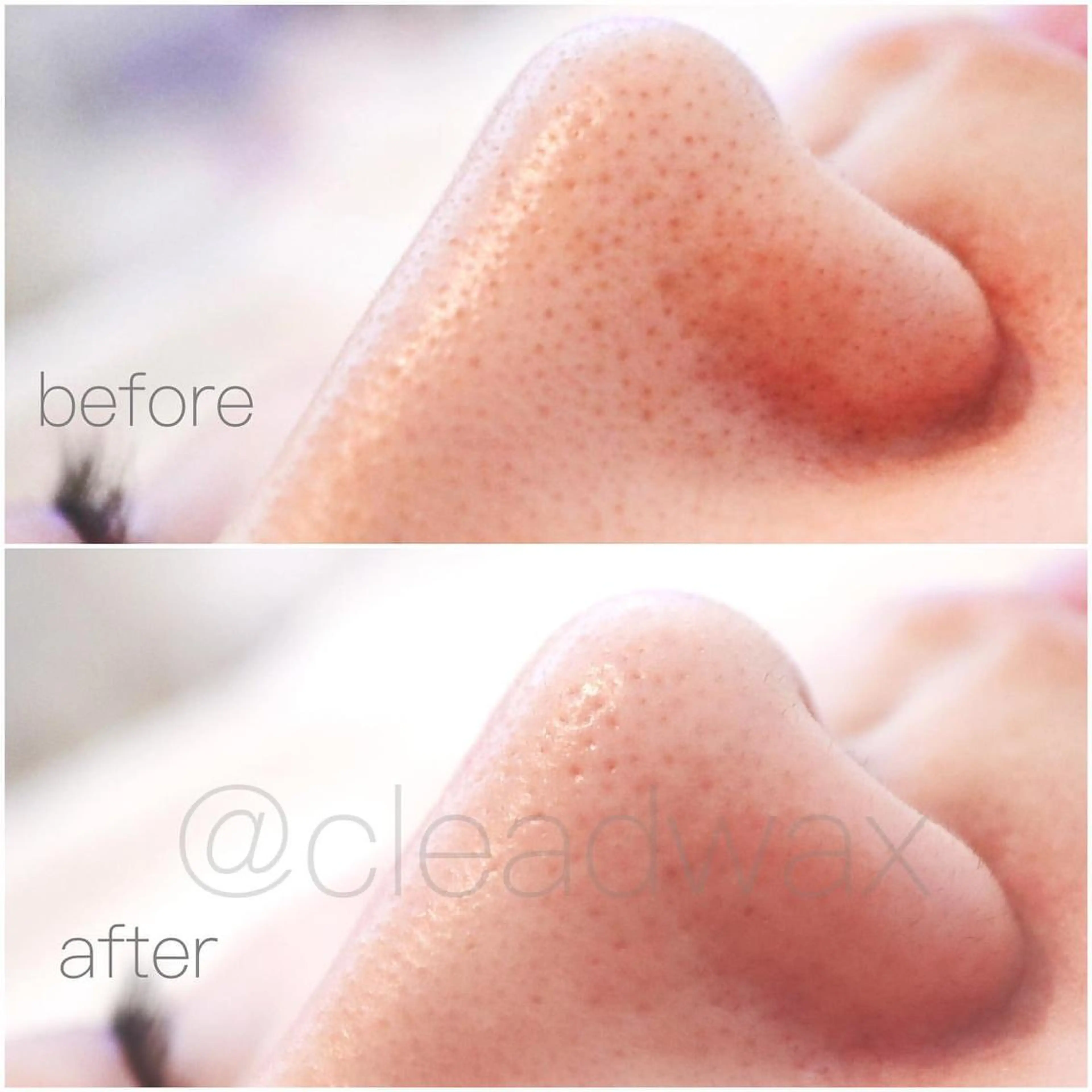 CLEAD赤坂見附店 坂田のエステ・リラクイメージ